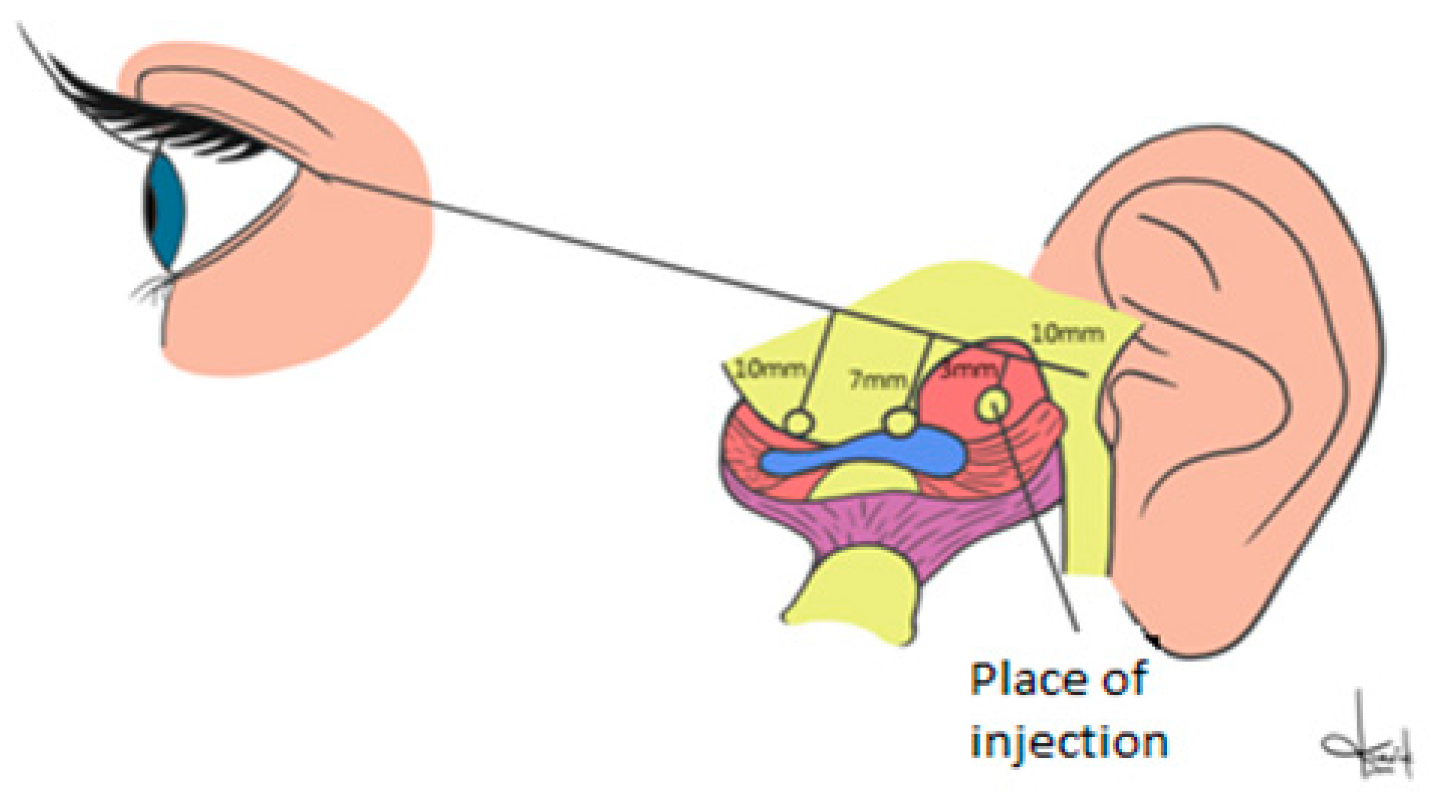 Ijerph 17 04726 g002