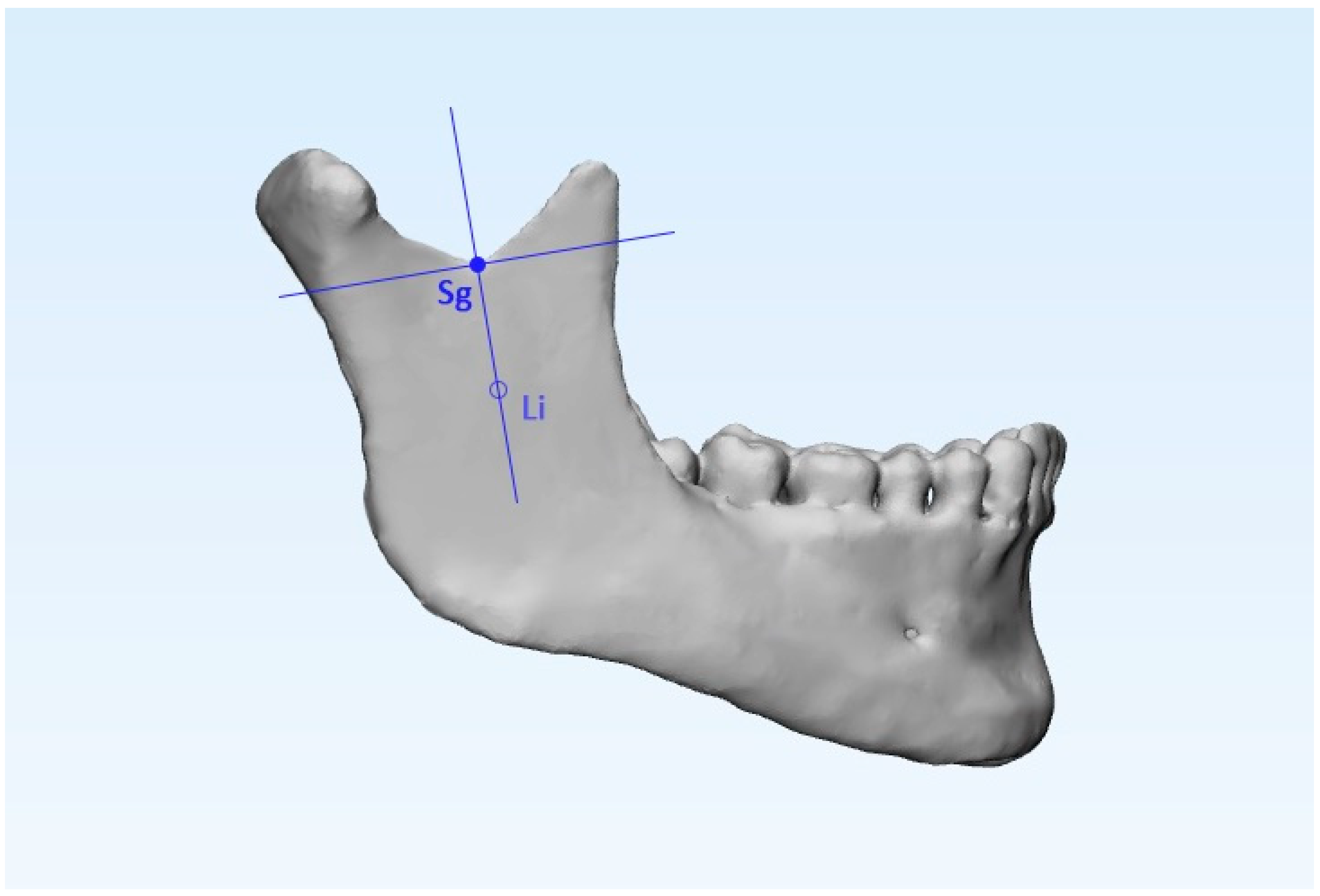 Ijerph 17 04789 g003