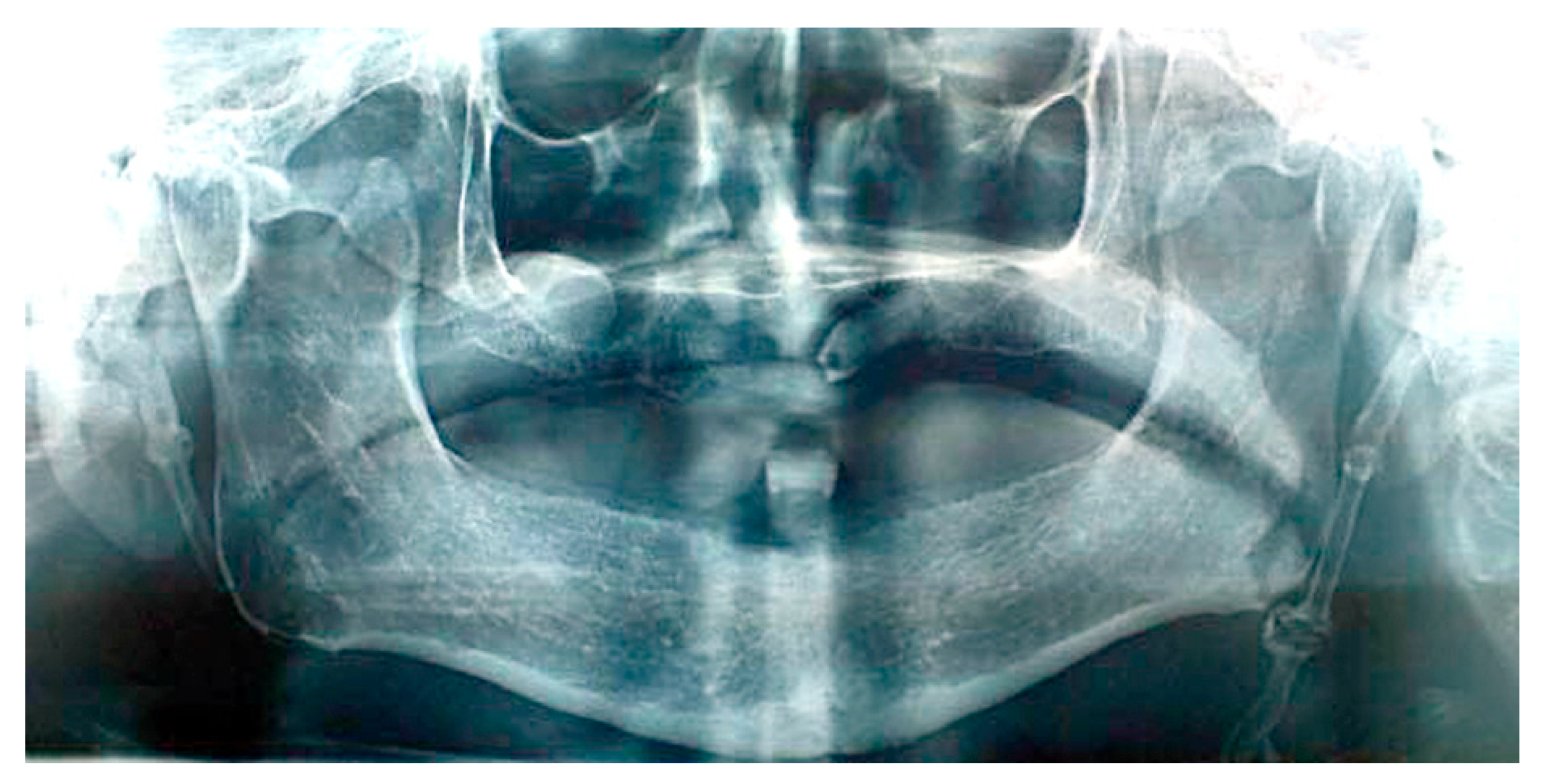 Ijerph 17 05654 g003