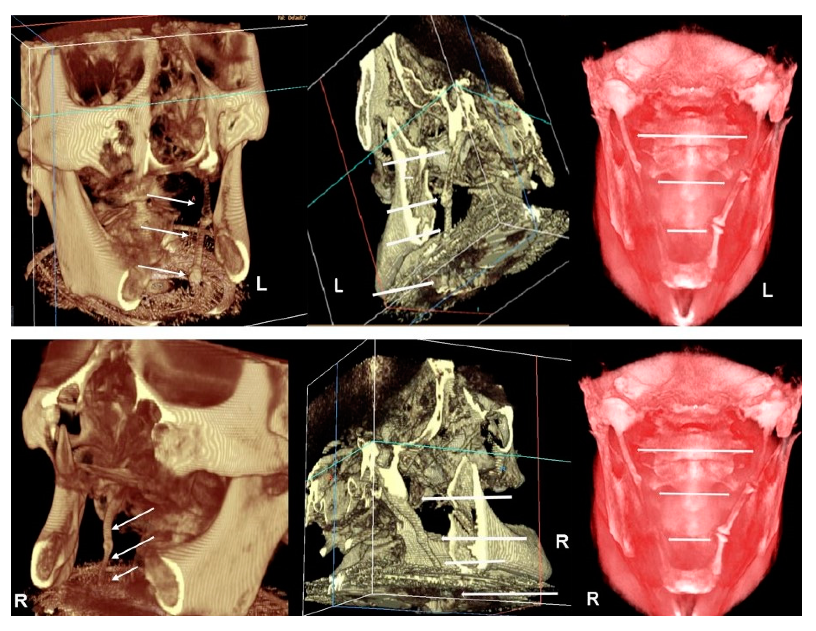 Ijerph 17 05654 g005