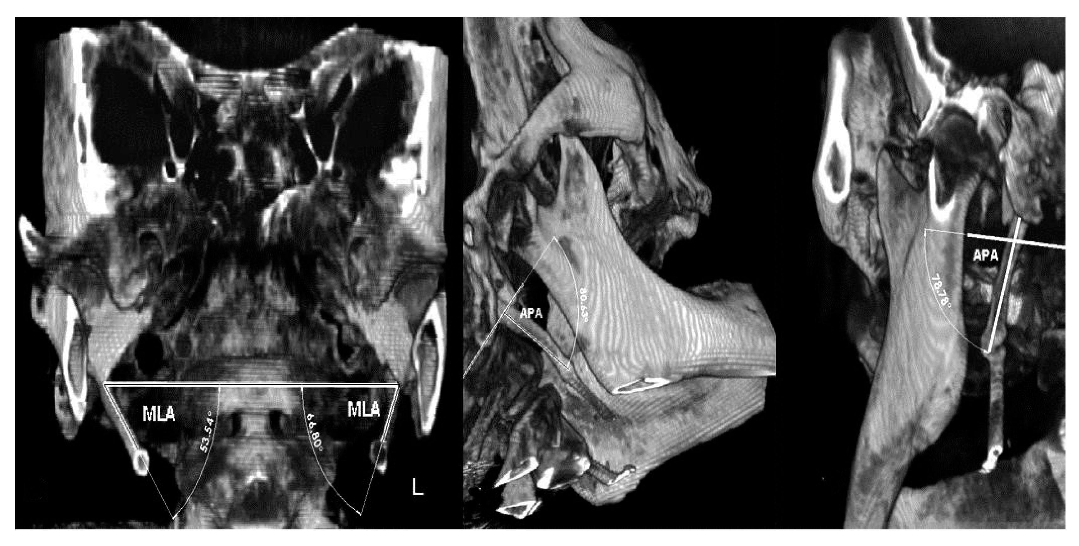 Ijerph 17 05654 g006