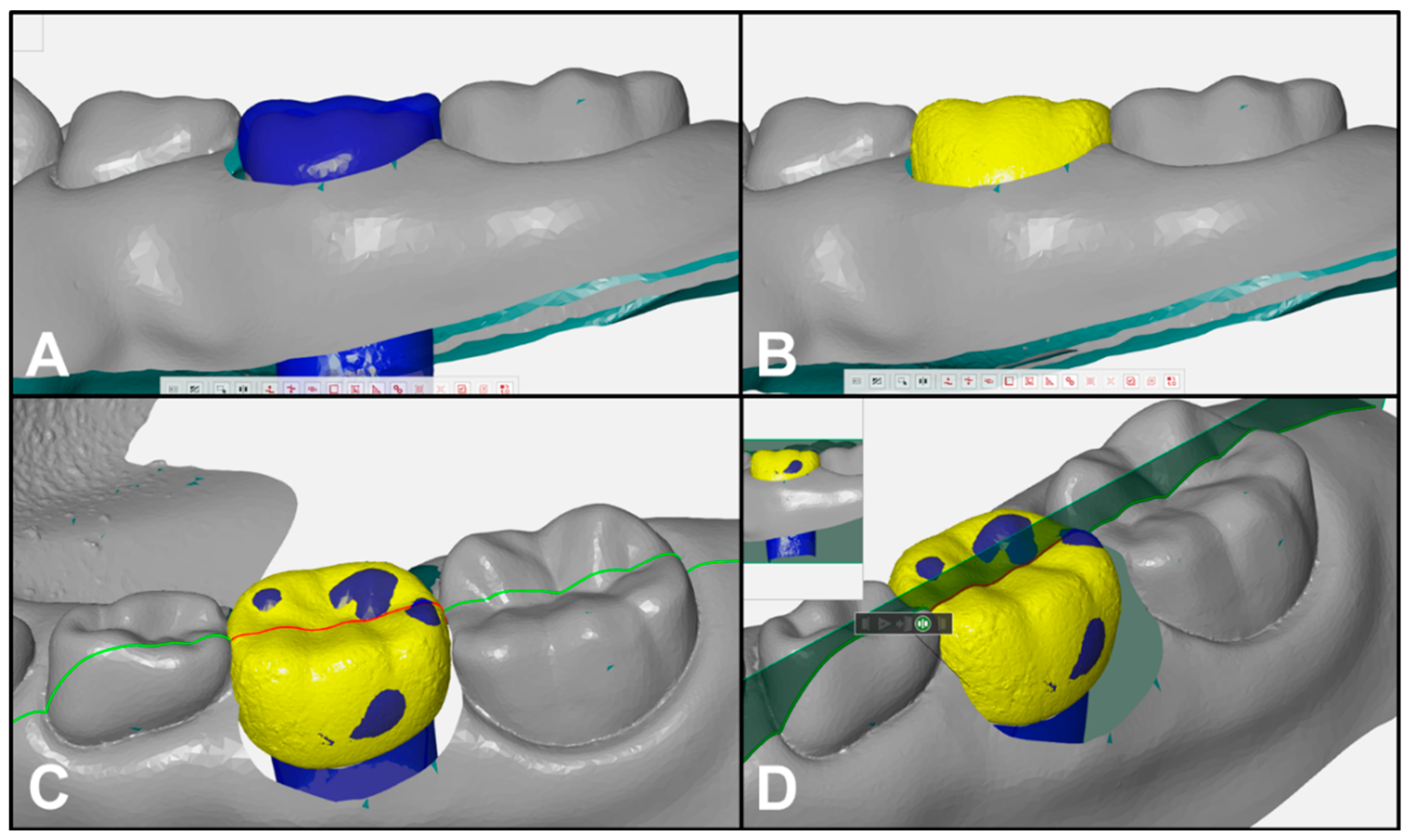 Ijerph 17 05732 g002