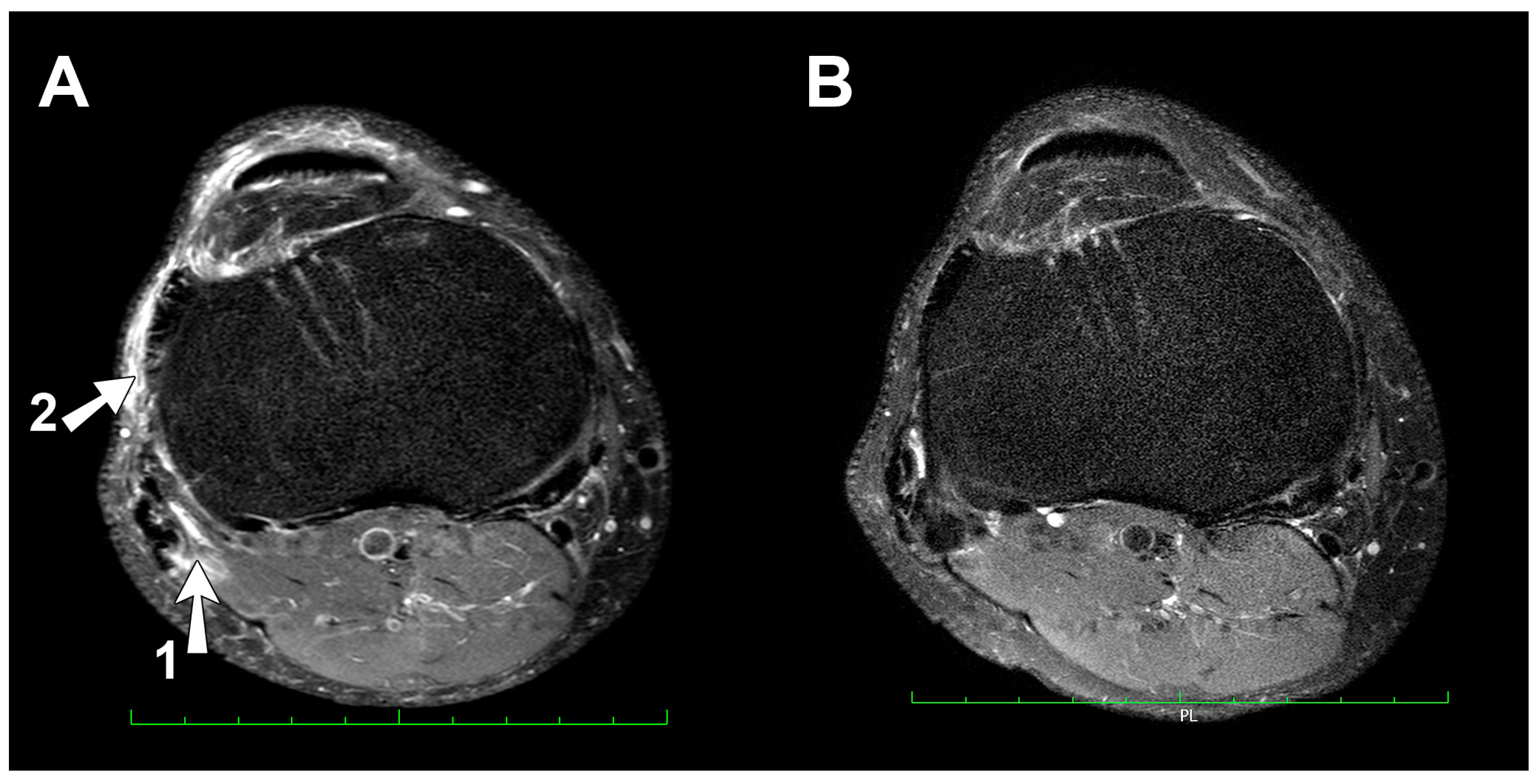 Ijerph 17 05955 g003