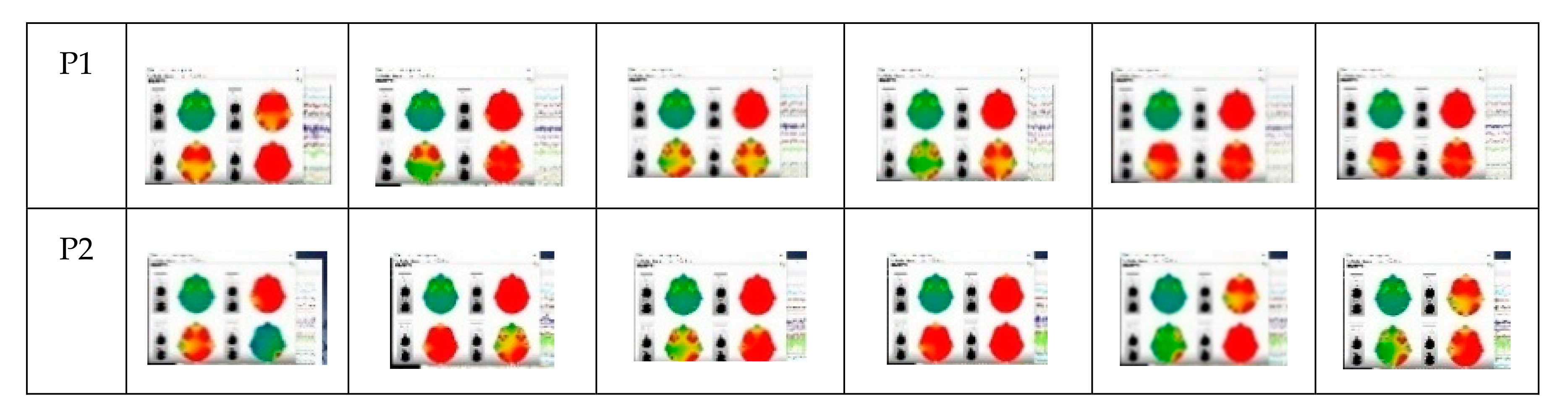 Ijerph 17 06796 g006a Ijerph 17 06796 g006a