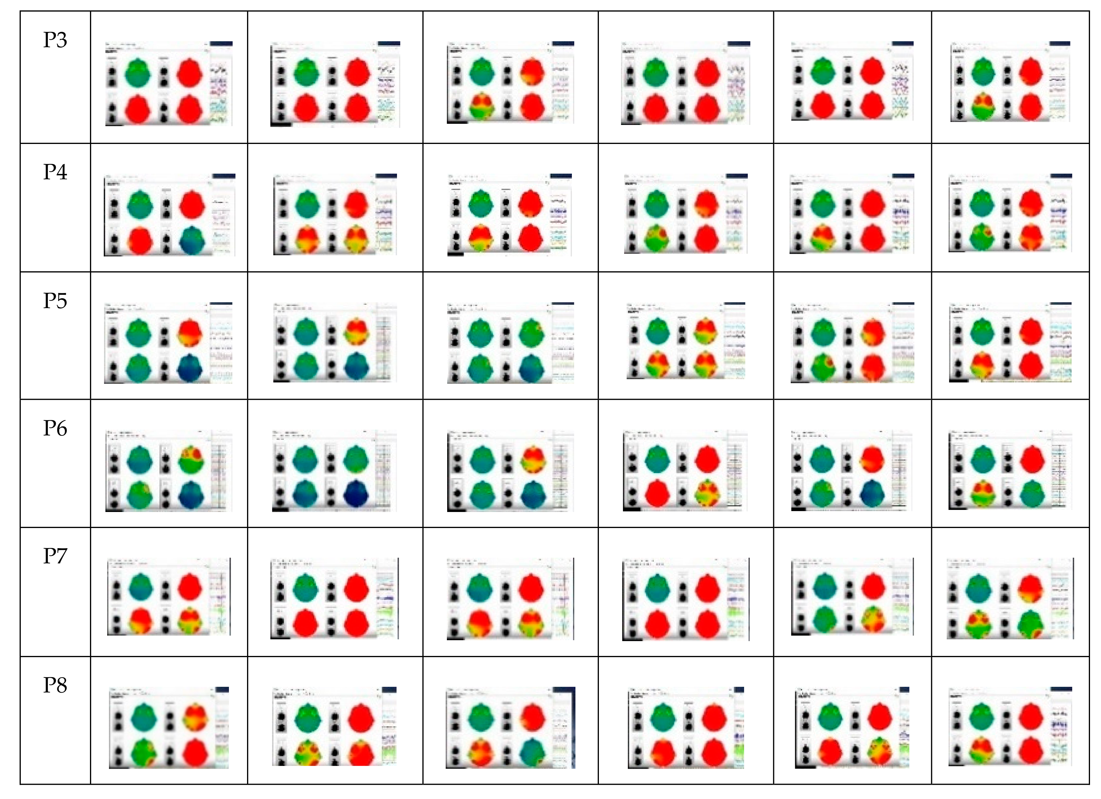 Ijerph 17 06796 g006b Ijerph 17 06796 g006b