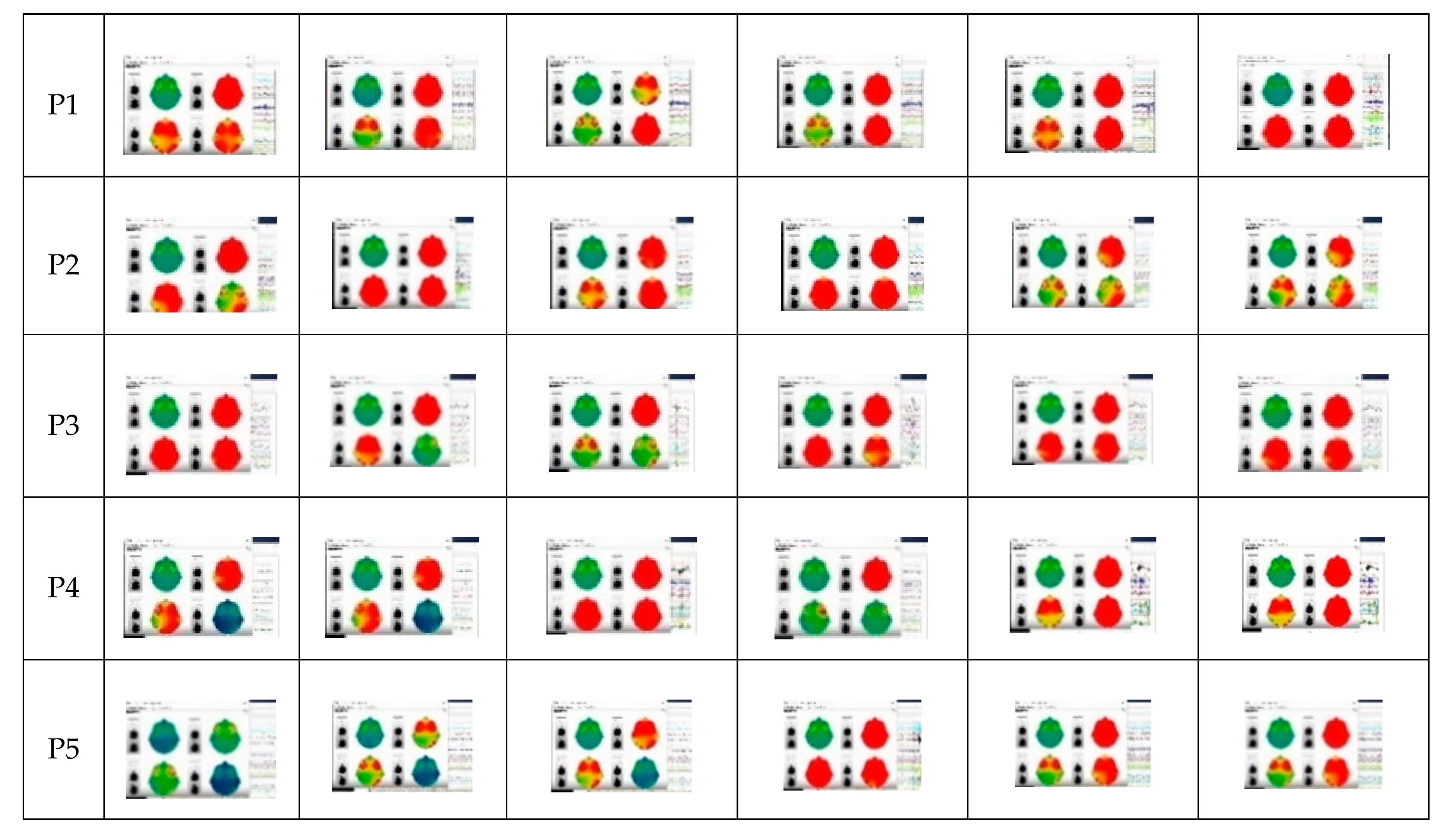 Ijerph 17 06796 g007a Ijerph 17 06796 g007a