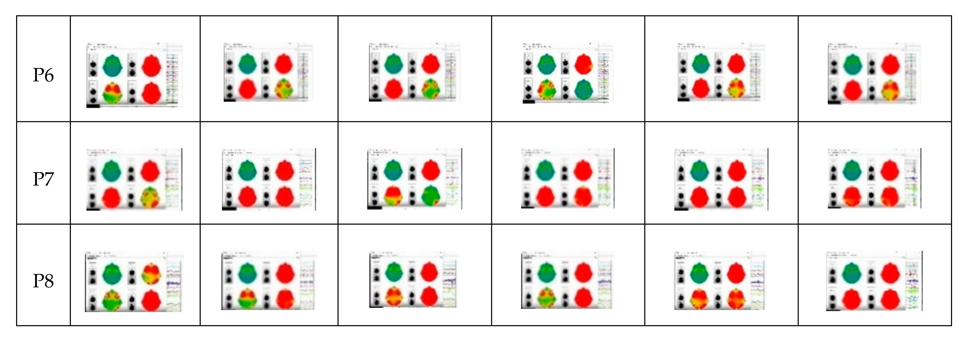 Ijerph 17 06796 g007b Ijerph 17 06796 g007b