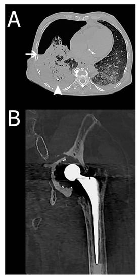Ijerph 17 07572 g002