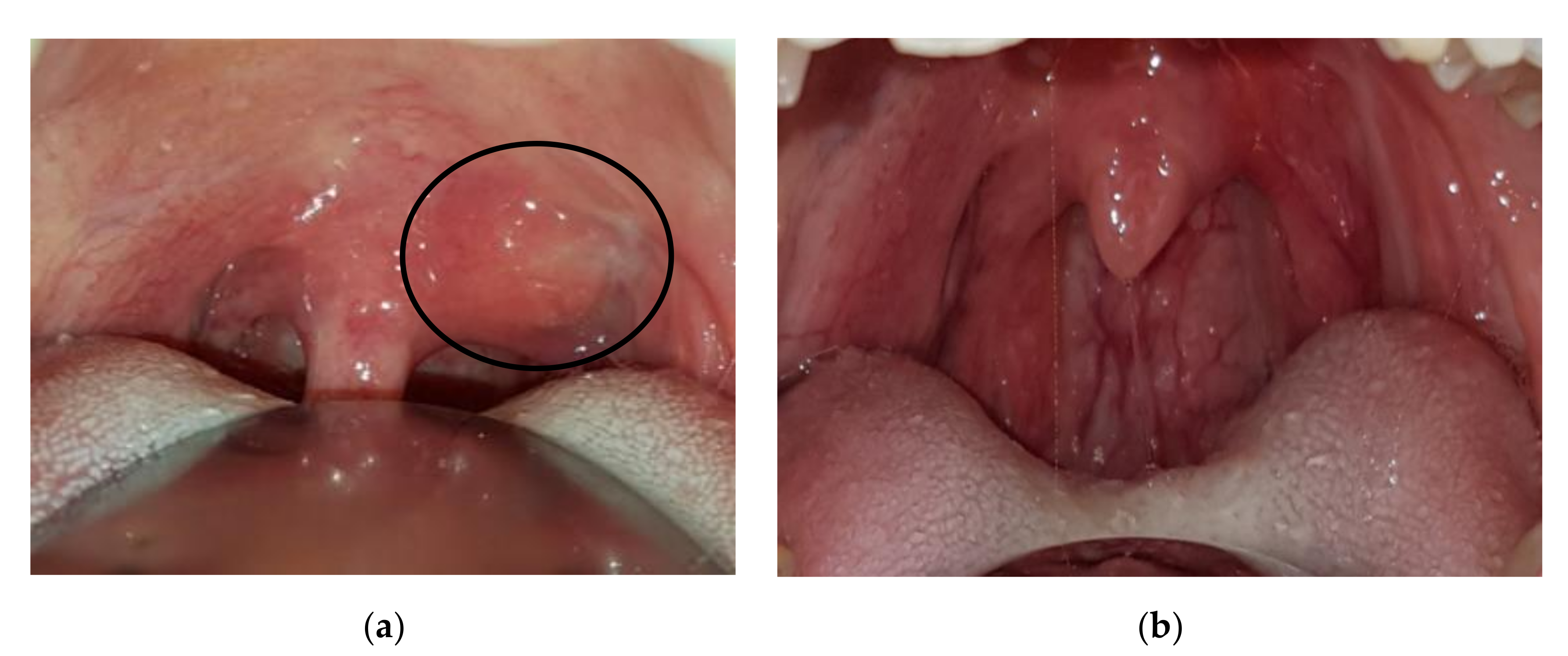 Ijerph 17 08179 g003 Ijerph 17 08179 g003