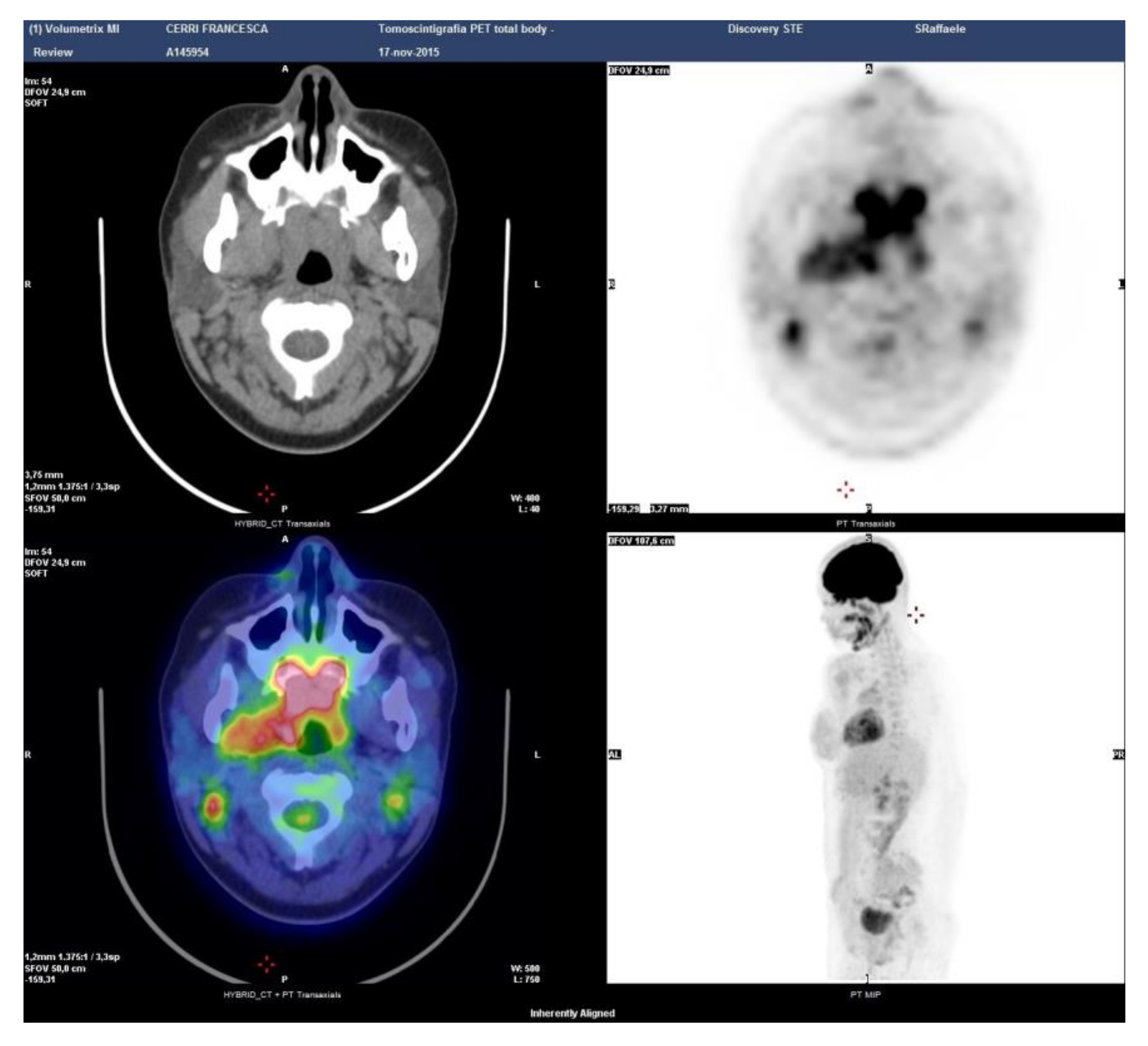 Ijerph 17 08179 g005 Ijerph 17 08179 g005