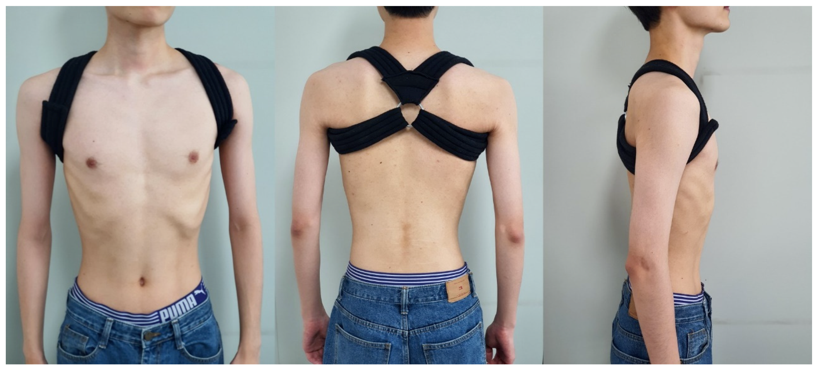 Ijerph 17 08494 g001 Ijerph 17 08494 g001