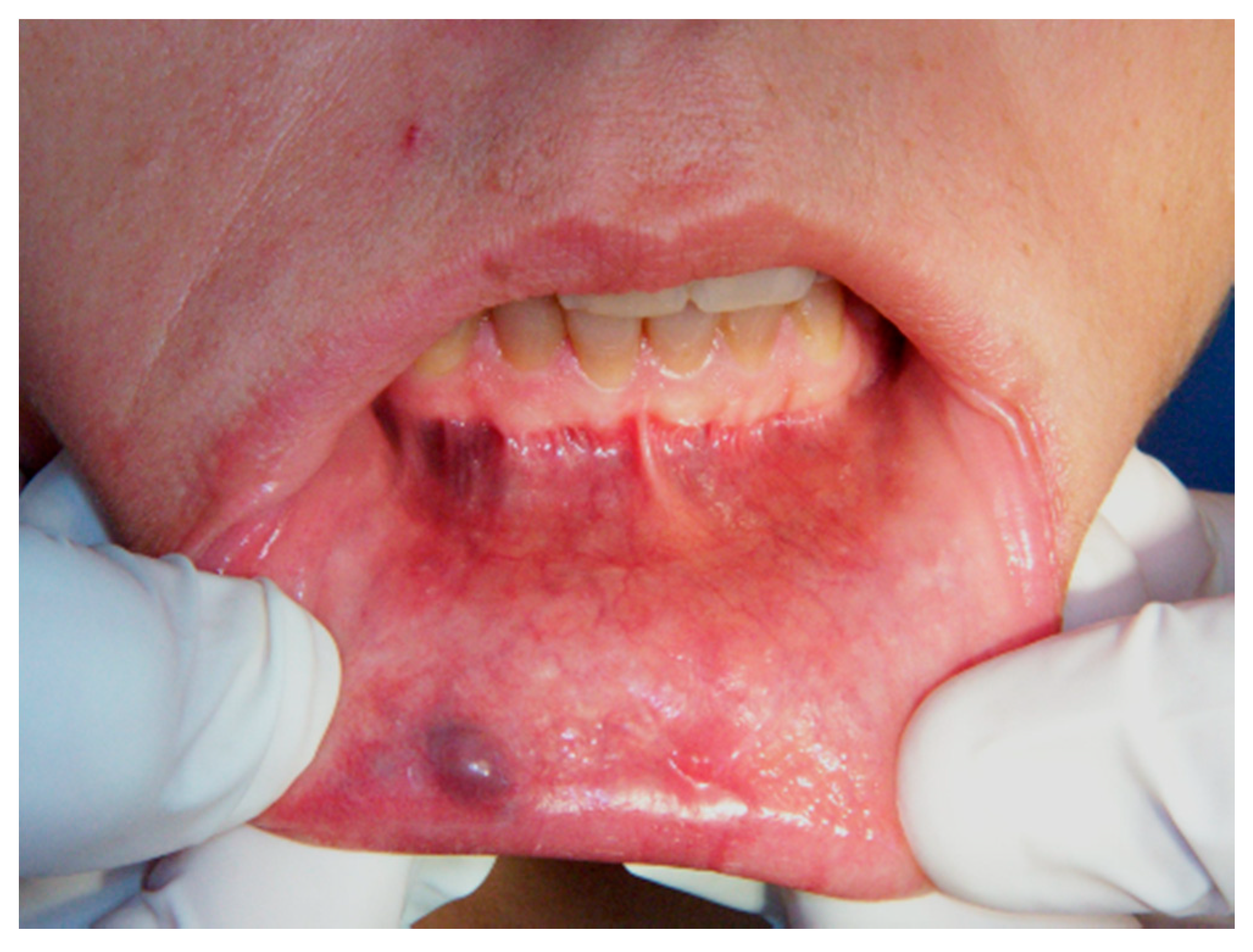 Ijerph 17 08665 g001 Ijerph 17 08665 g001