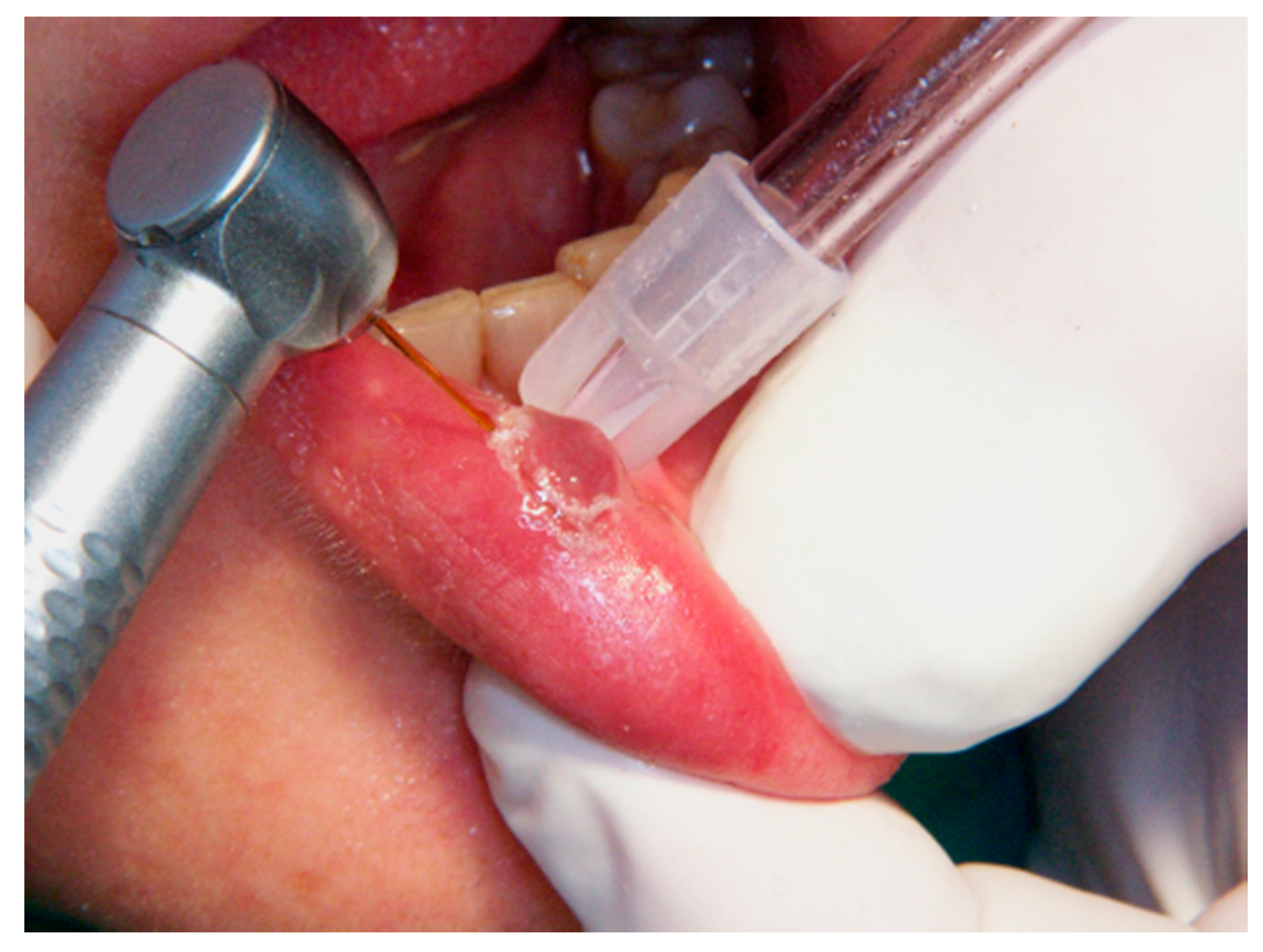 Ijerph 17 08665 g002 Ijerph 17 08665 g002