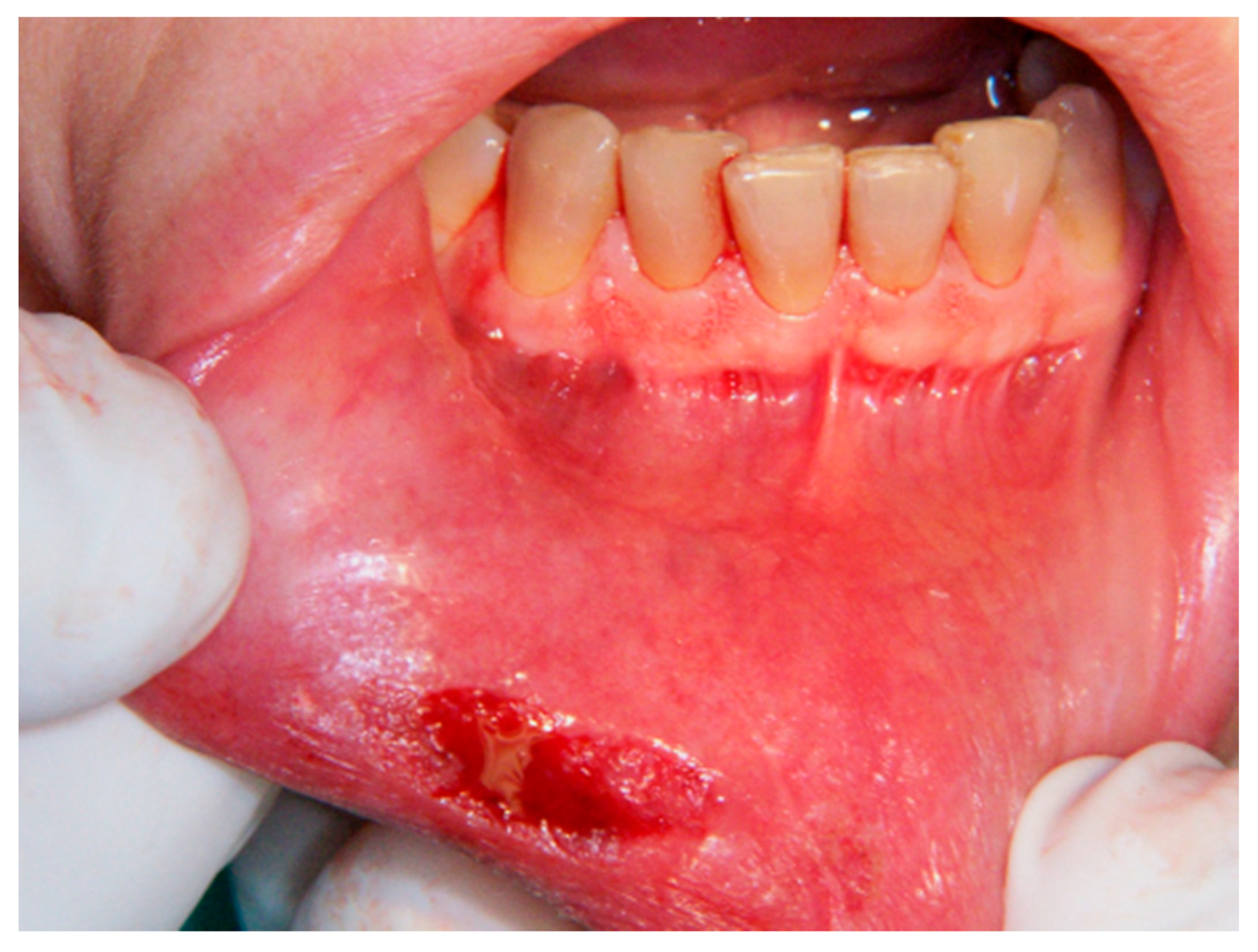 Ijerph 17 08665 g003 Ijerph 17 08665 g003