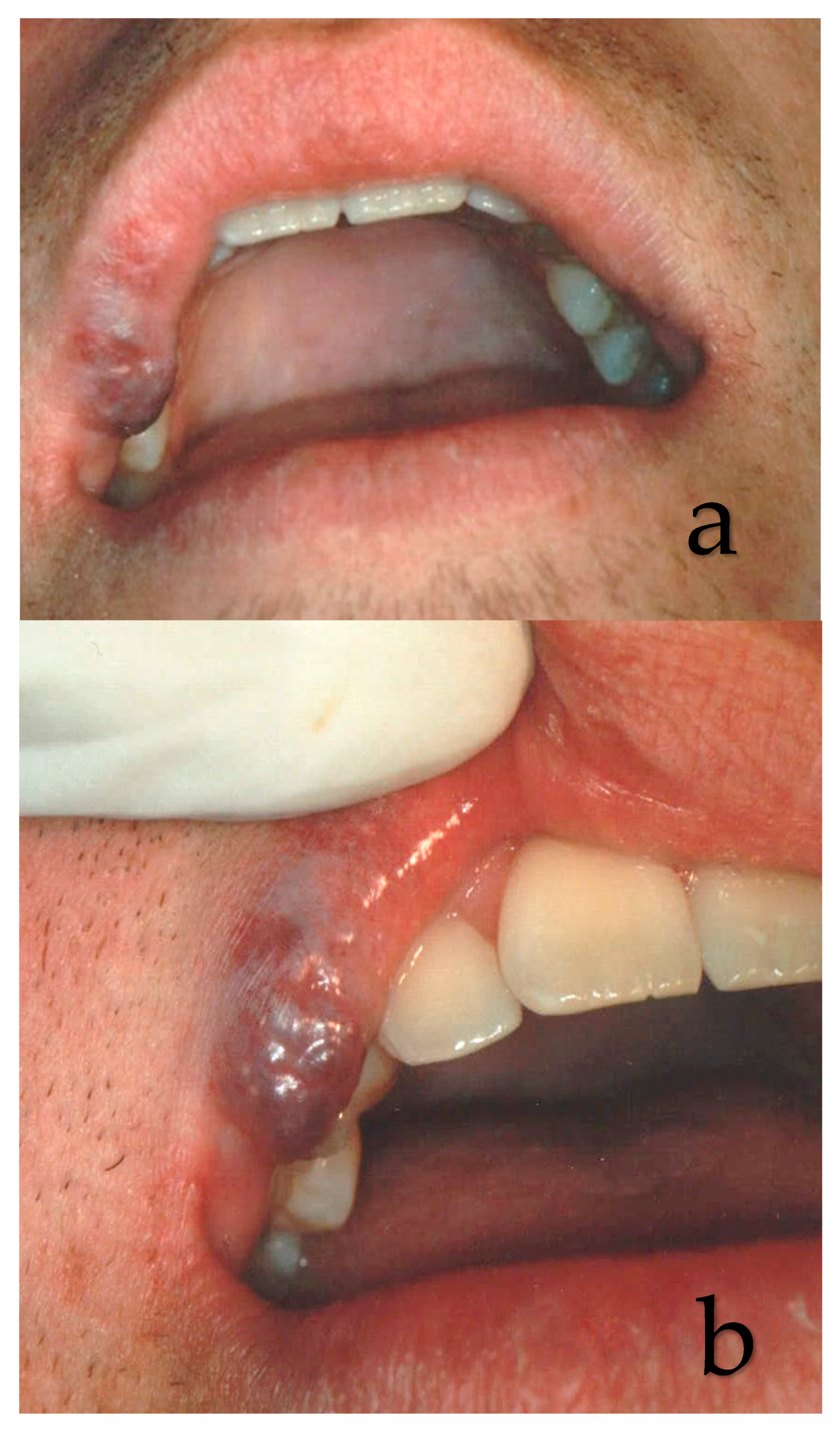 Ijerph 17 08665 g004 Ijerph 17 08665 g004