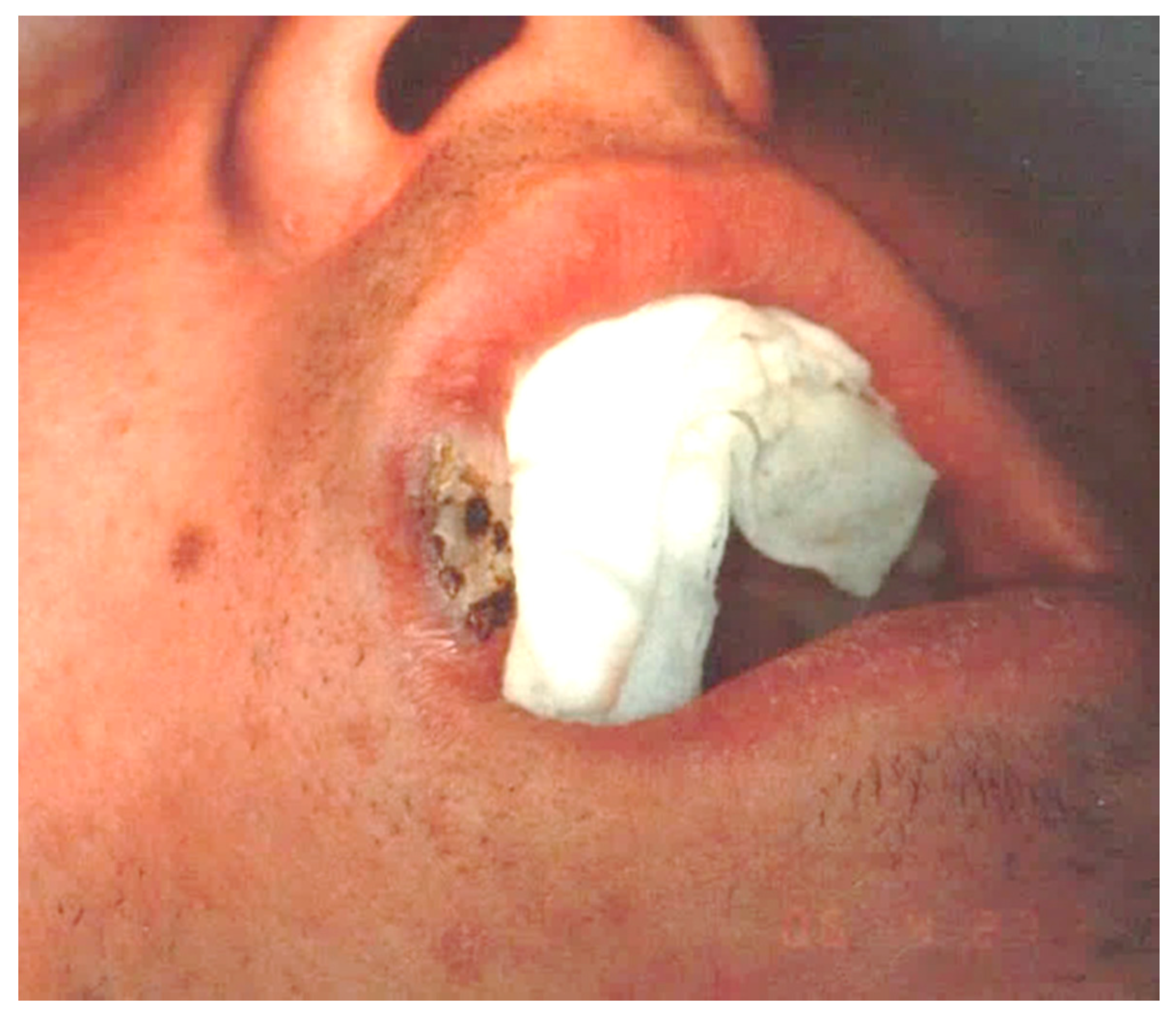 Ijerph 17 08665 g005 Ijerph 17 08665 g005