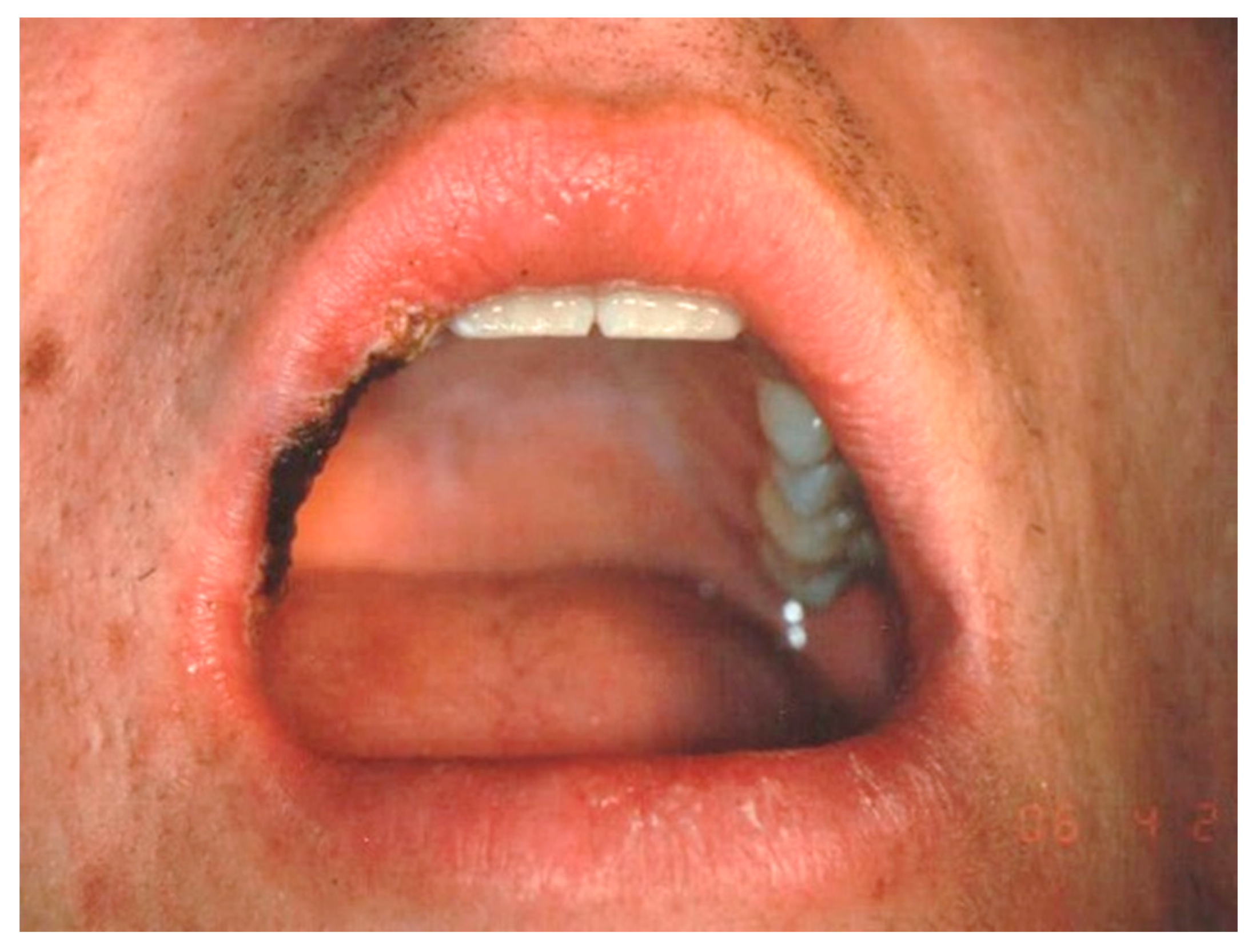 Ijerph 17 08665 g006 Ijerph 17 08665 g006