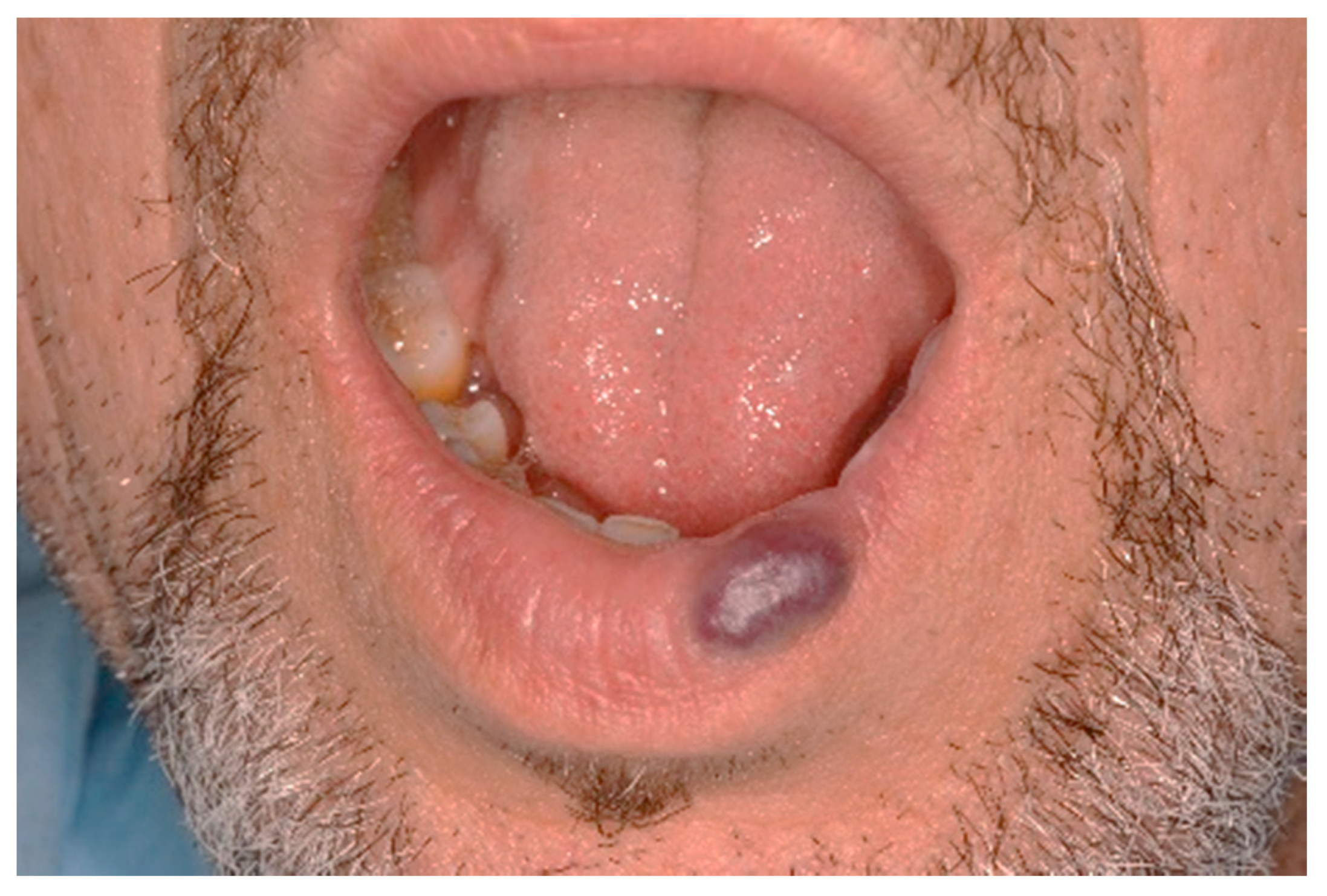 Ijerph 17 08665 g007 Ijerph 17 08665 g007