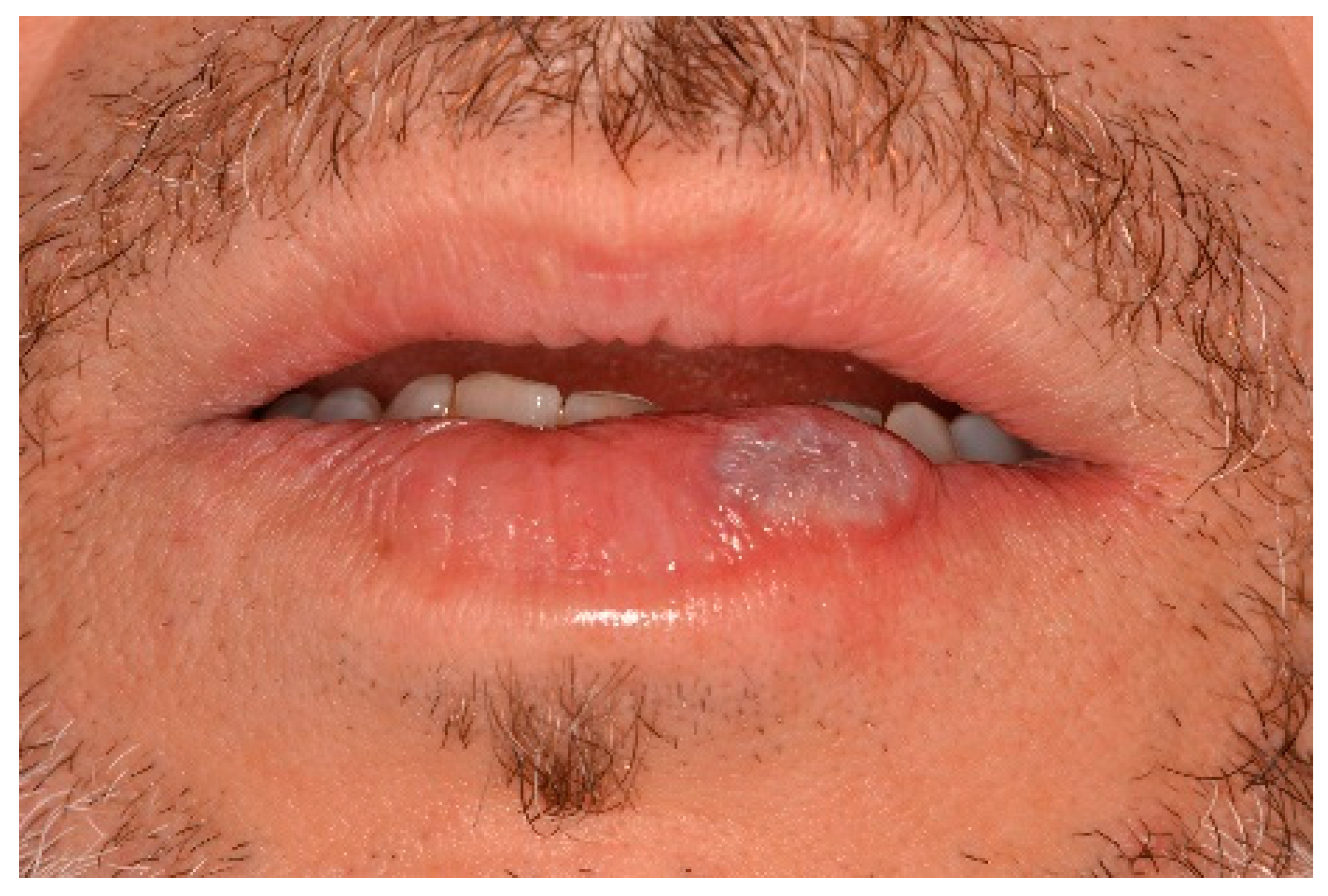 Ijerph 17 08665 g008 Ijerph 17 08665 g008