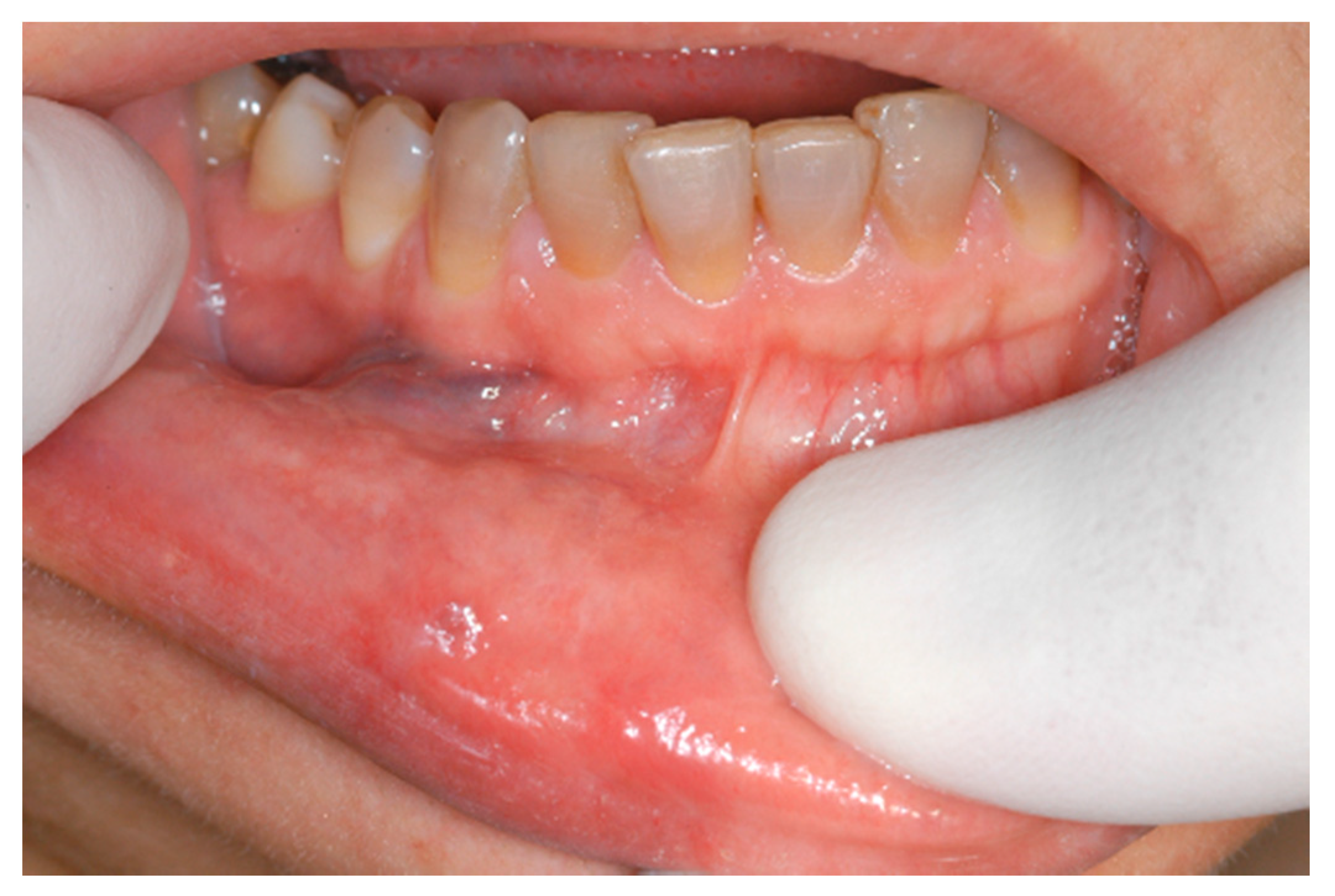 Ijerph 17 08665 g011 Ijerph 17 08665 g011