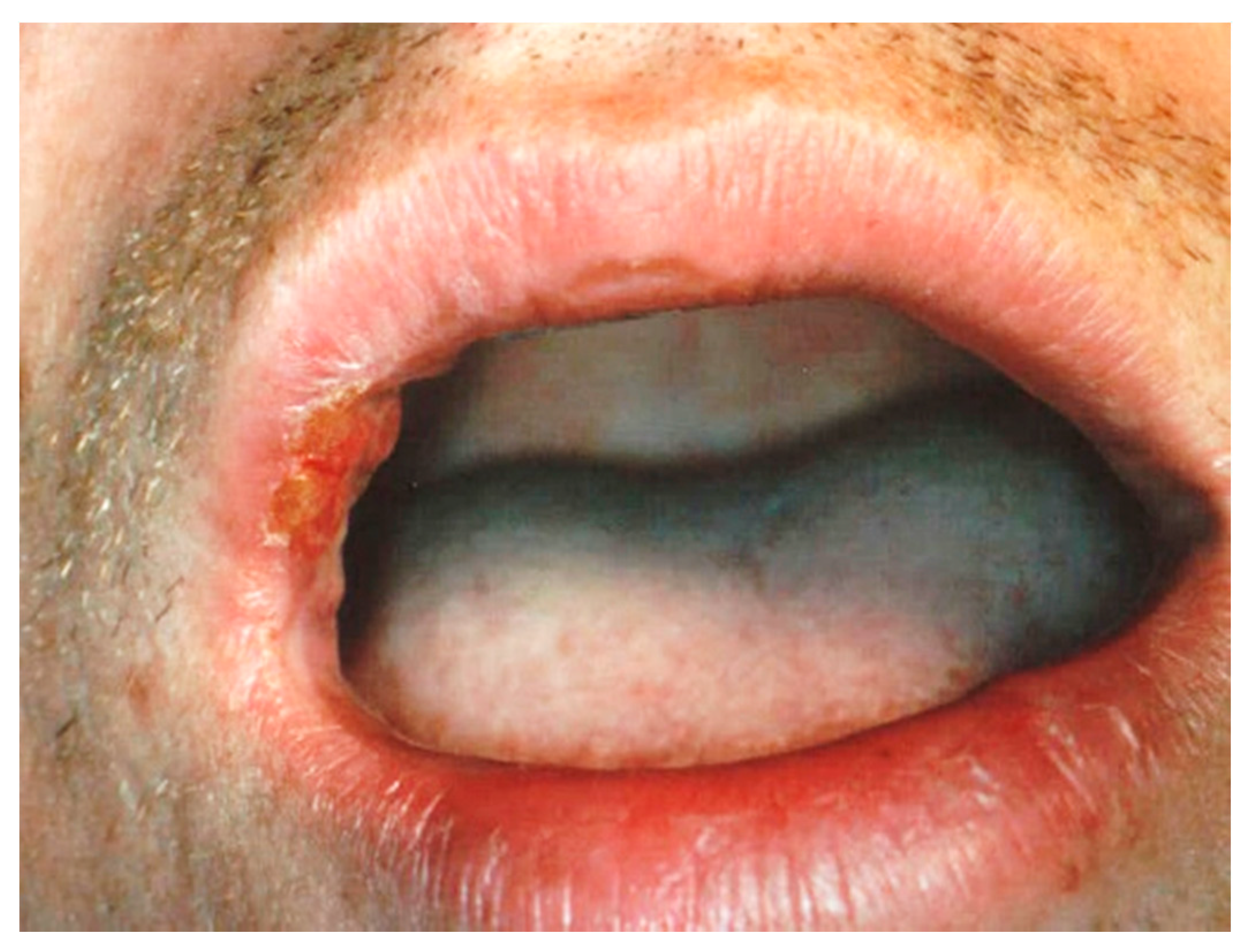 Ijerph 17 08665 g012 Ijerph 17 08665 g012