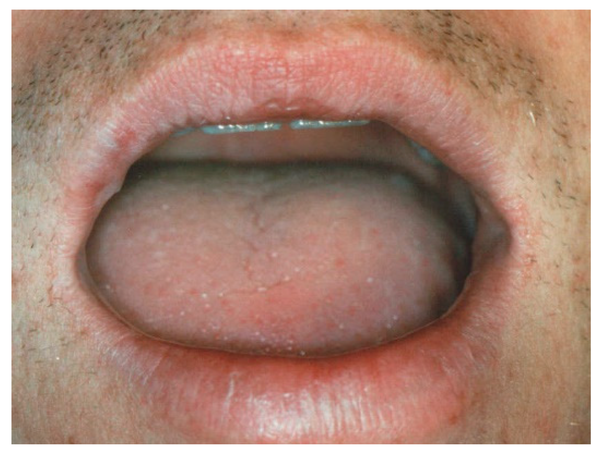 Ijerph 17 08665 g013 Ijerph 17 08665 g013