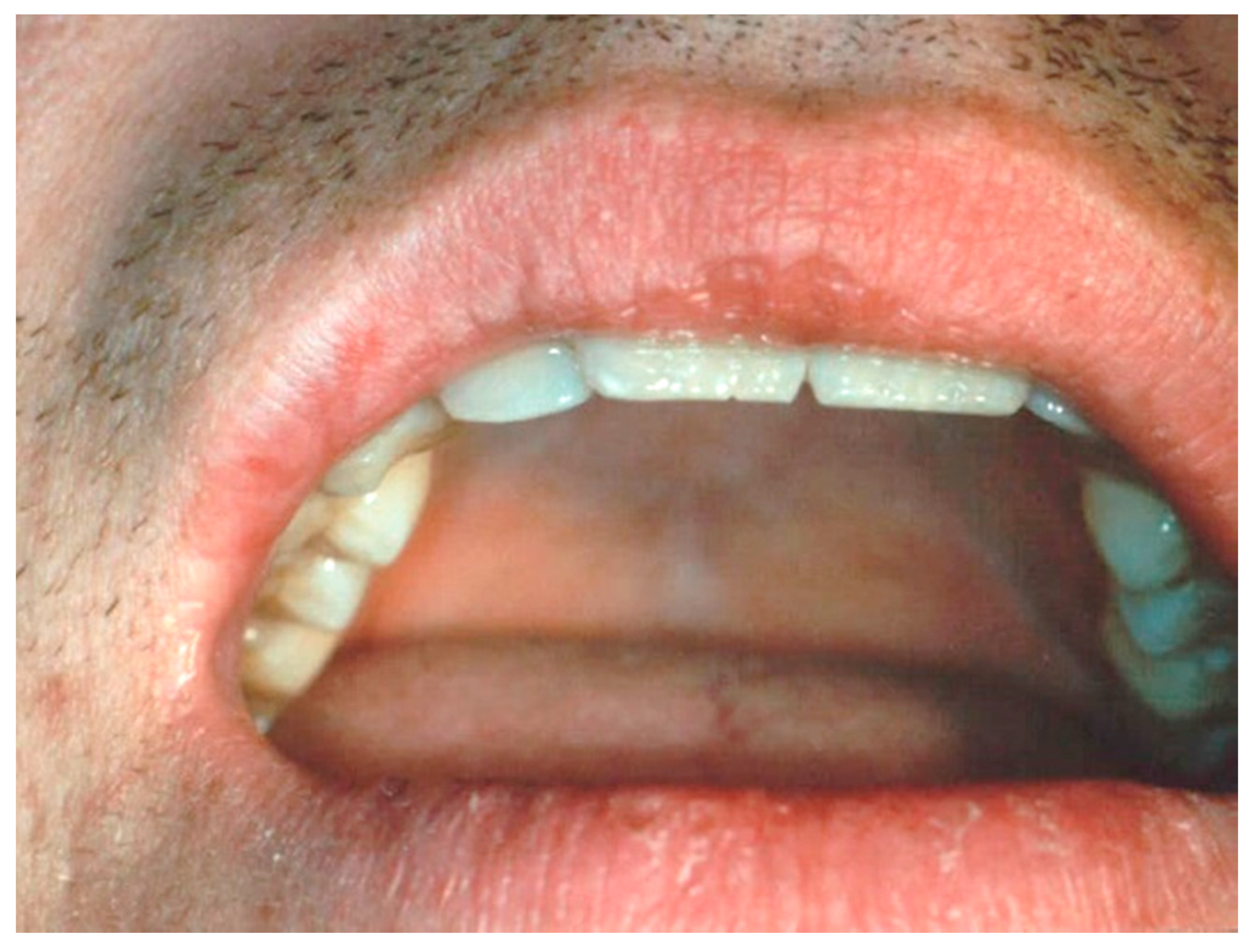 Ijerph 17 08665 g014 Ijerph 17 08665 g014