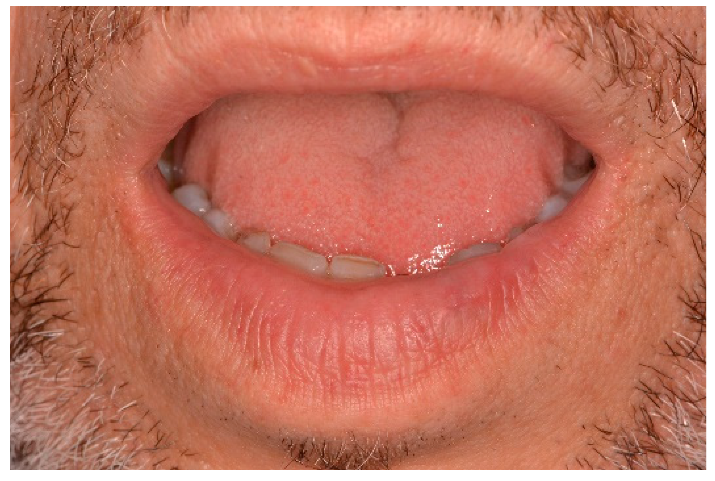 Ijerph 17 08665 g015 Ijerph 17 08665 g015