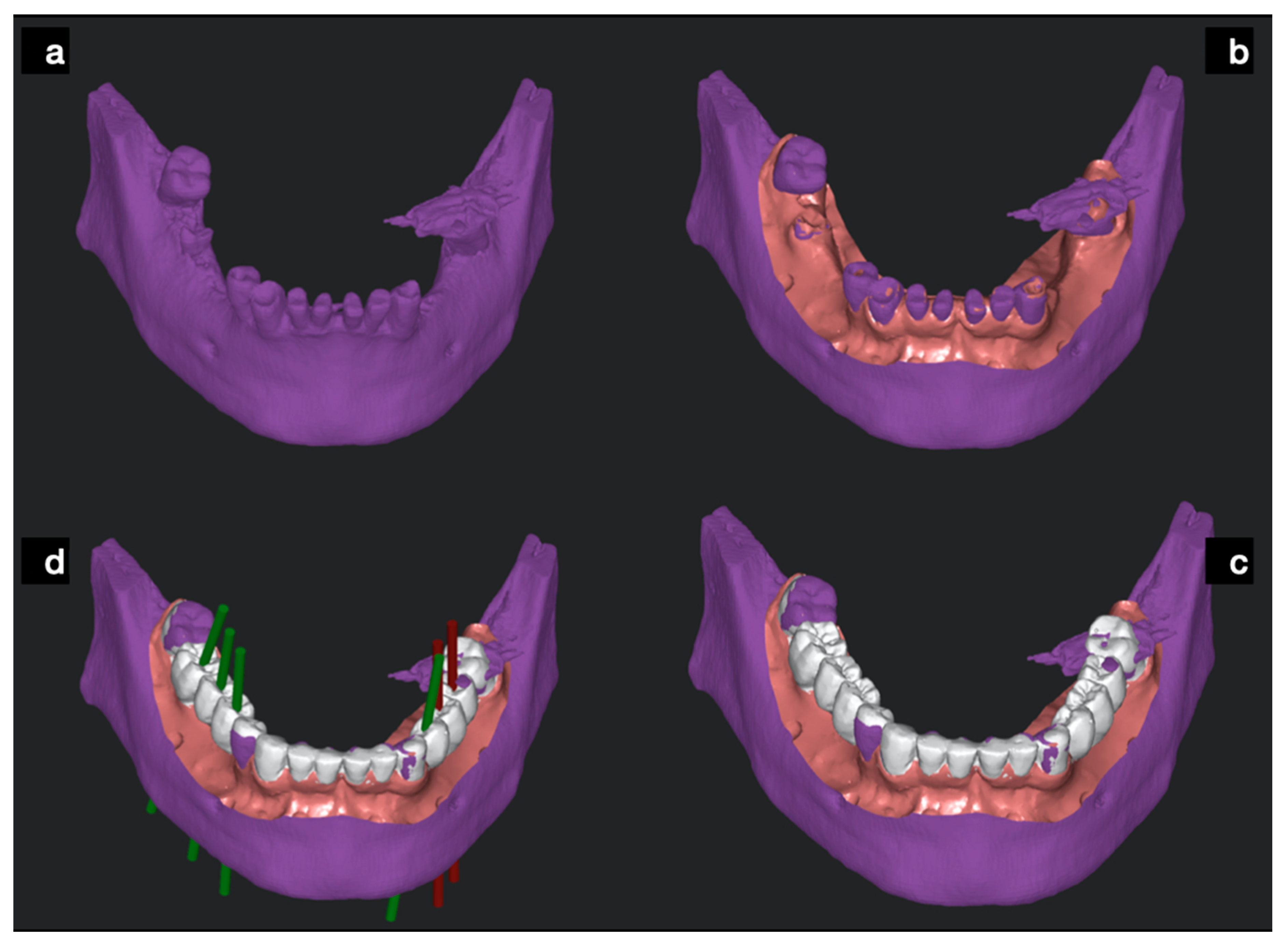 Ijerph 17 09358 g003