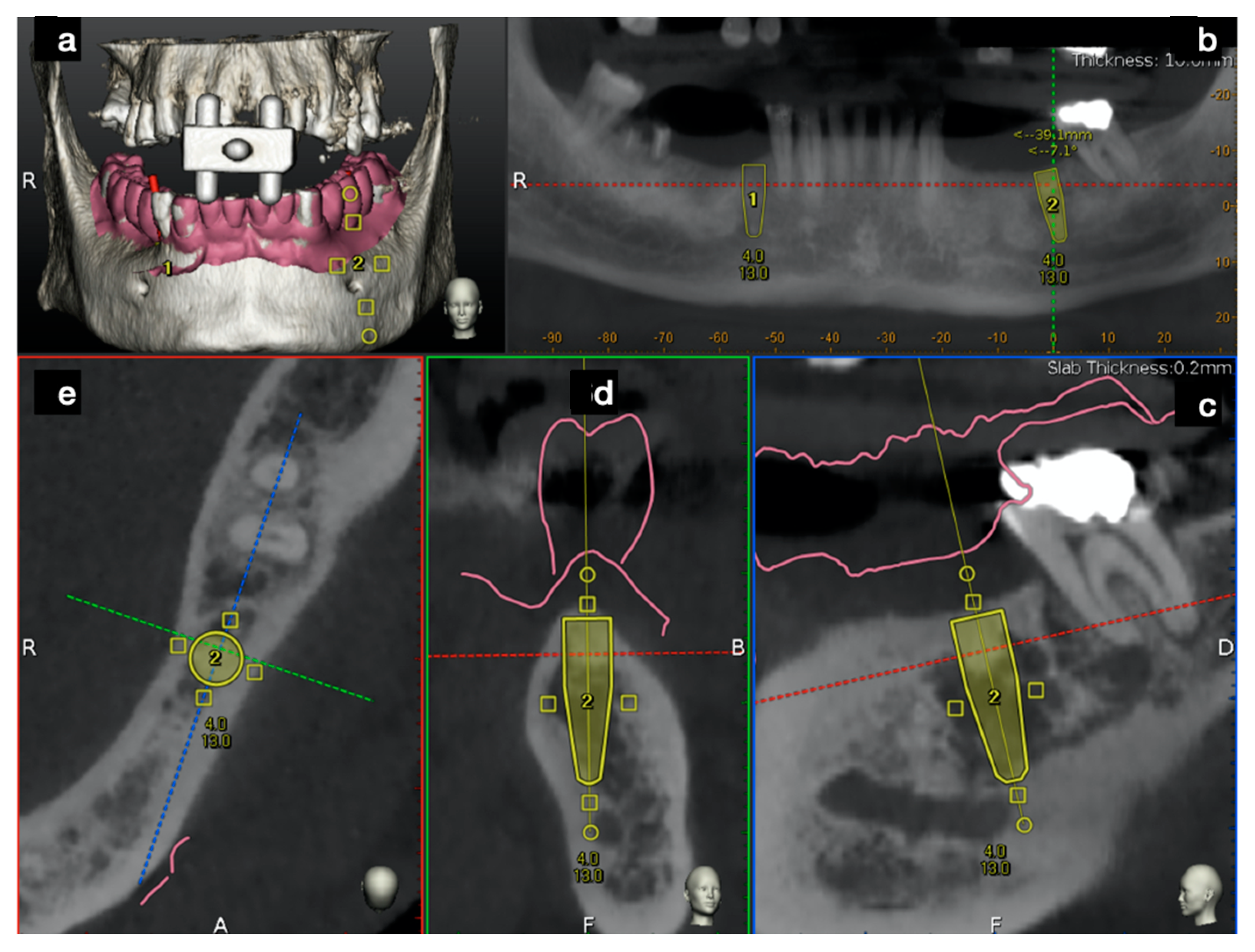 Ijerph 17 09358 g006