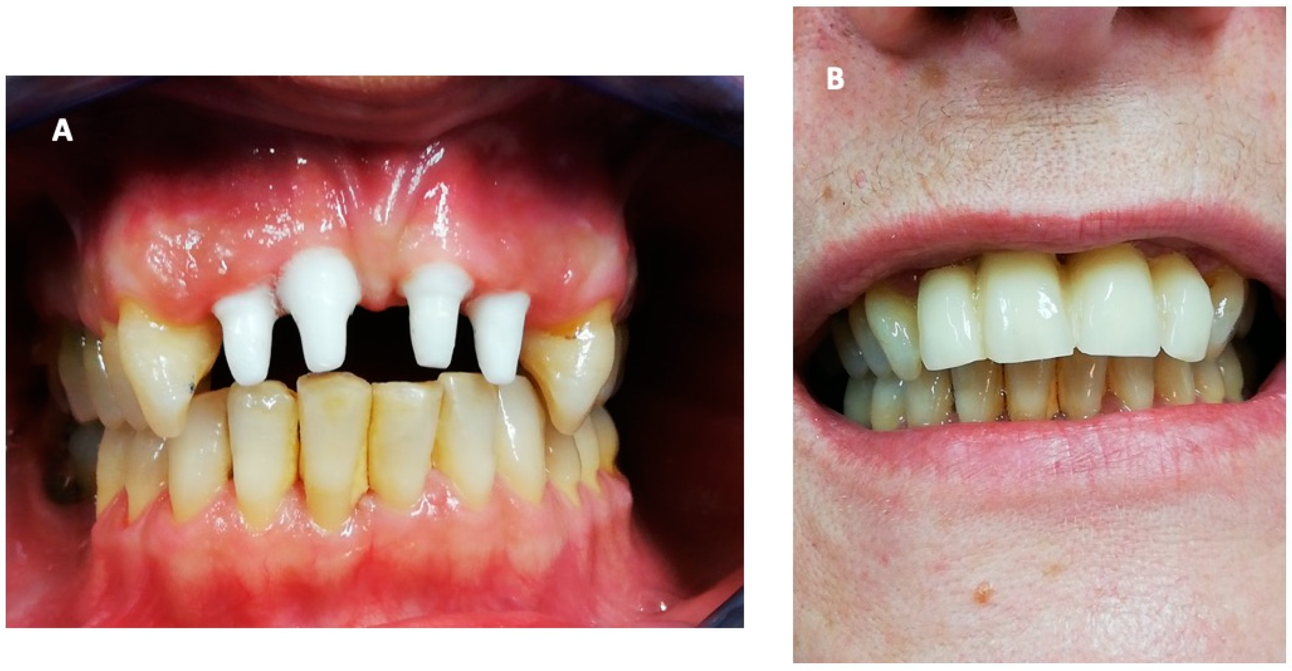 Ijerph 18 00413 g005