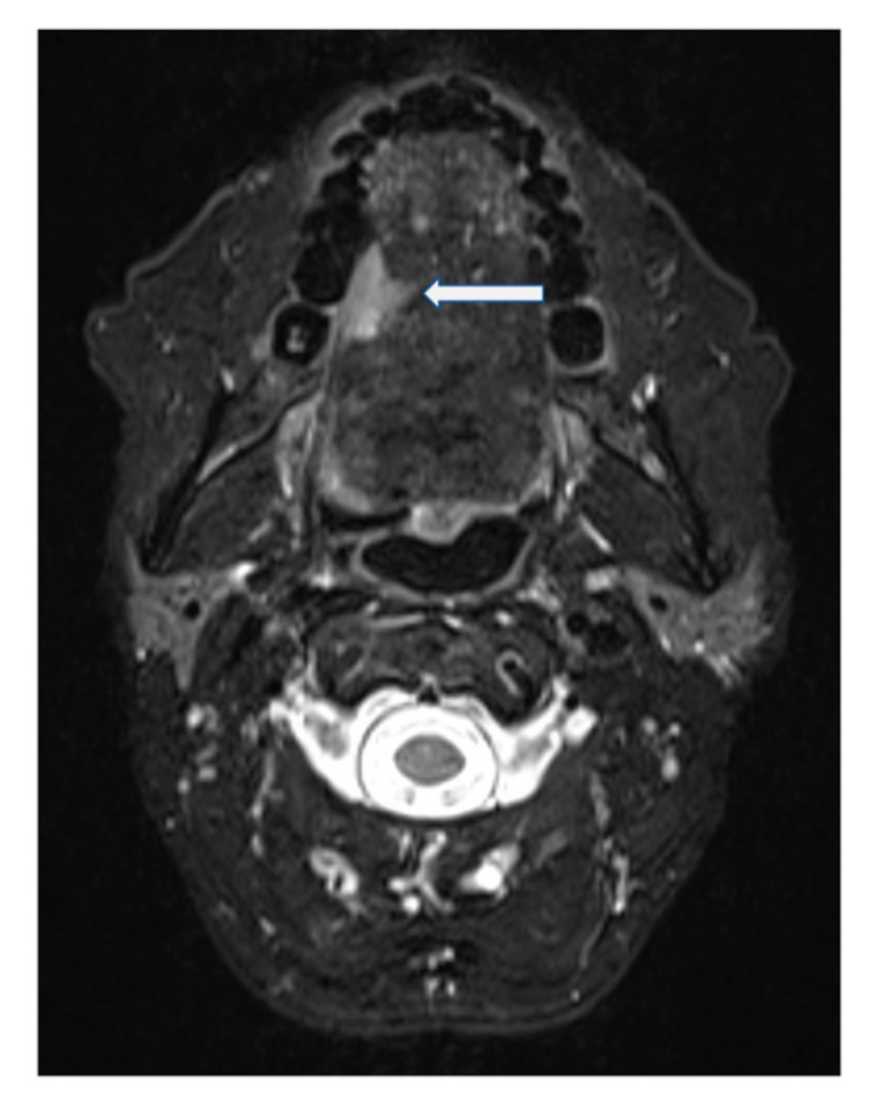 Ijerph 18 00911 g003