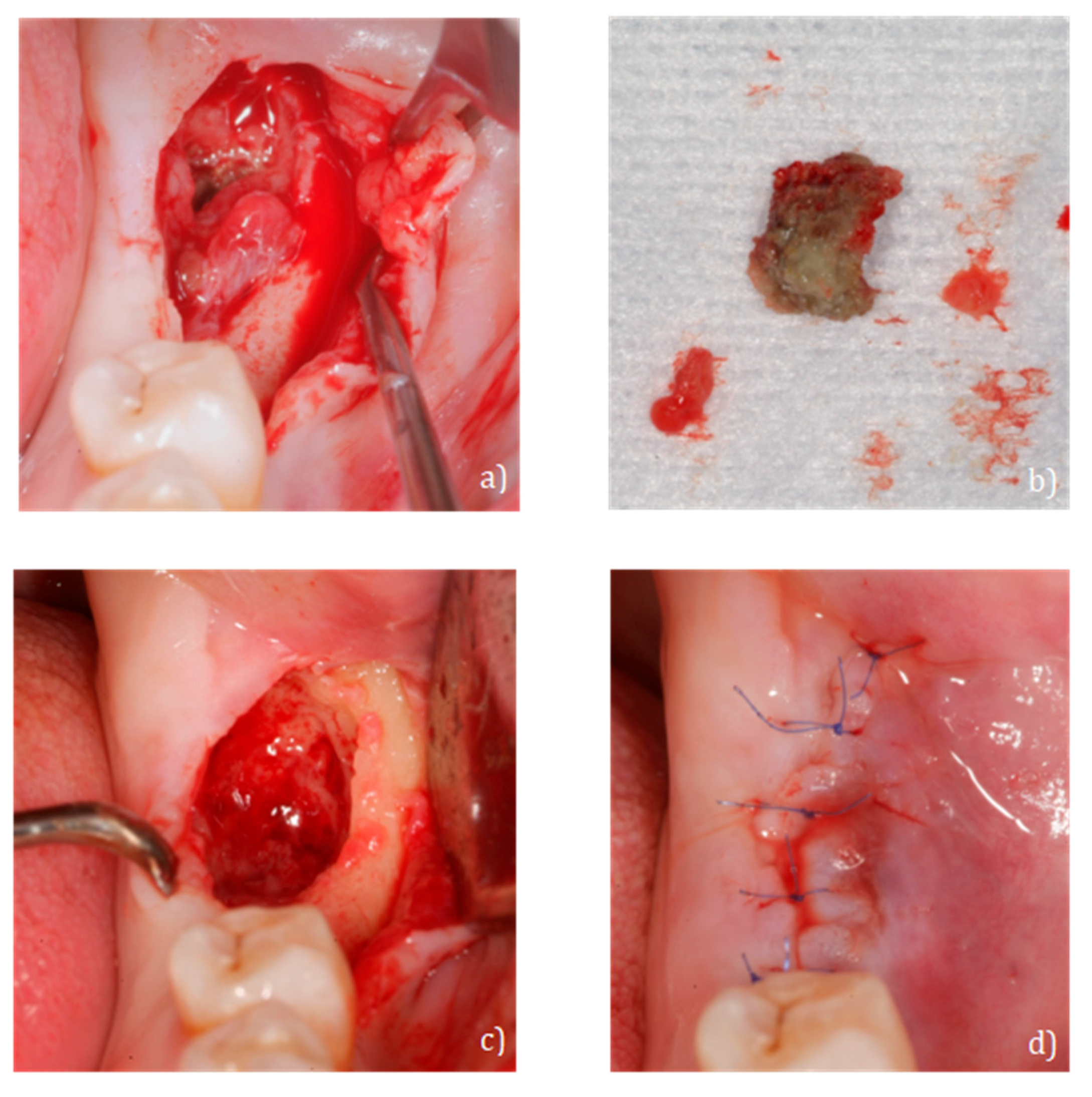 Ijerph 18 01018 g005