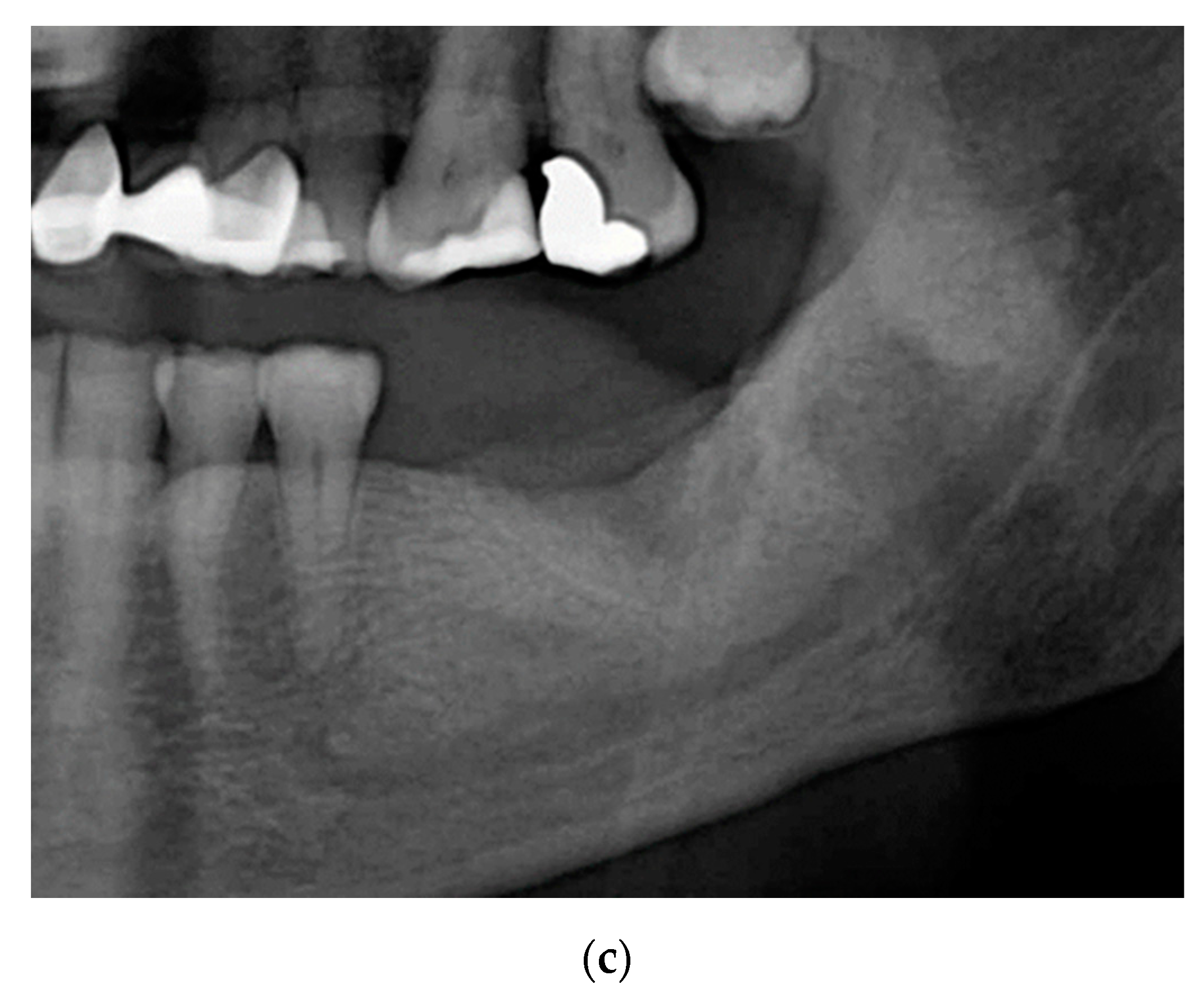 Ijerph 18 01018 g006b
