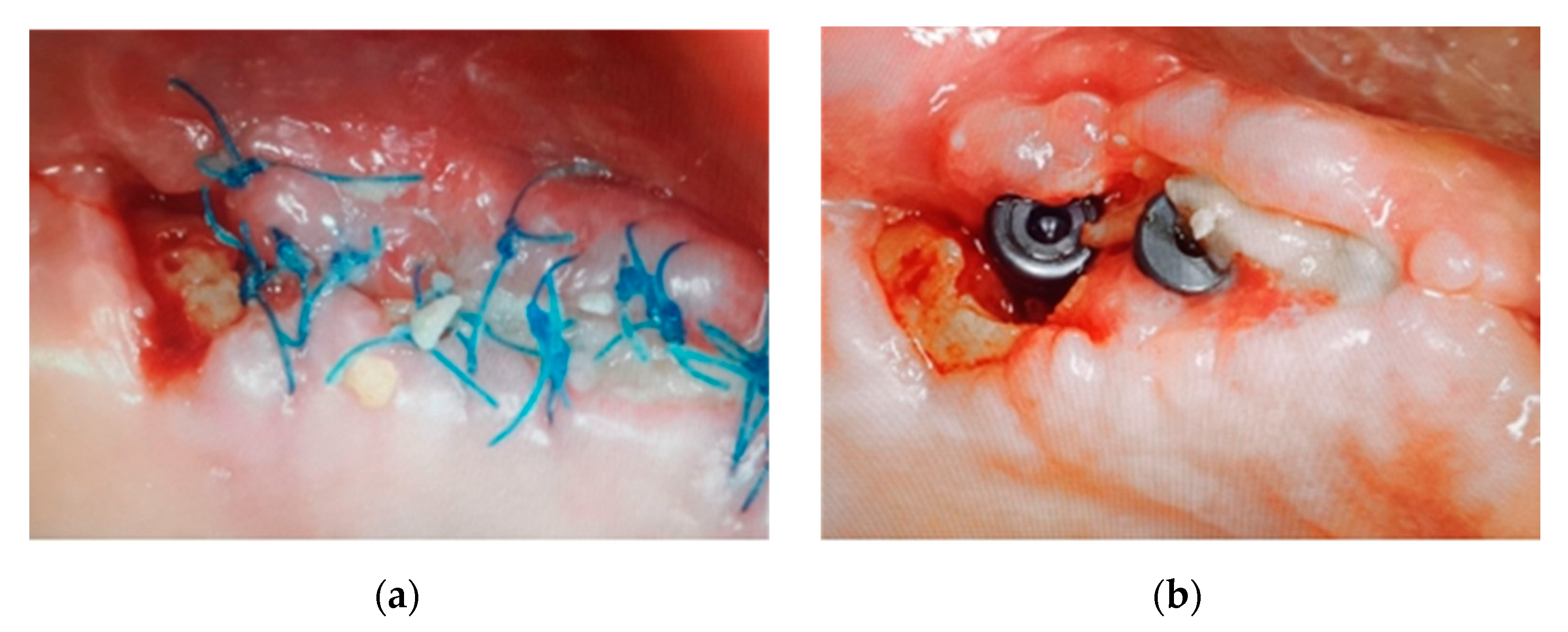 Ijerph 18 01018 g007