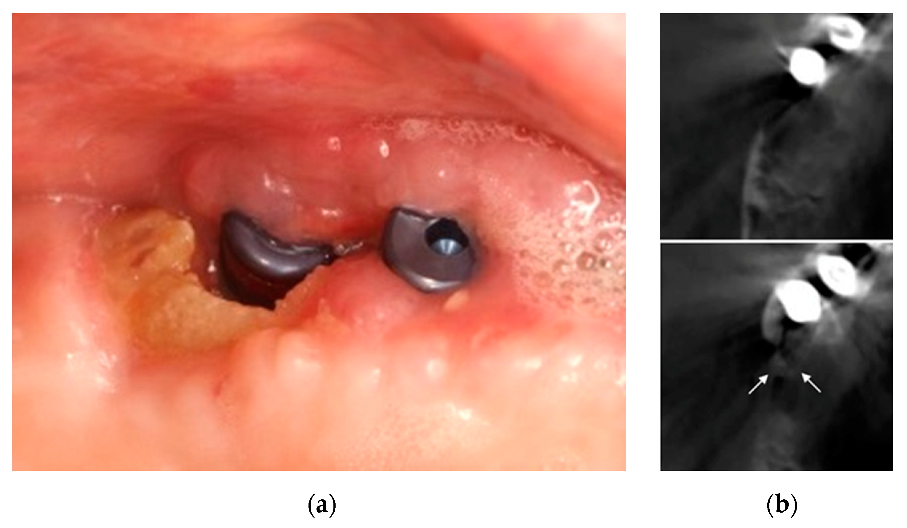 Ijerph 18 01018 g008