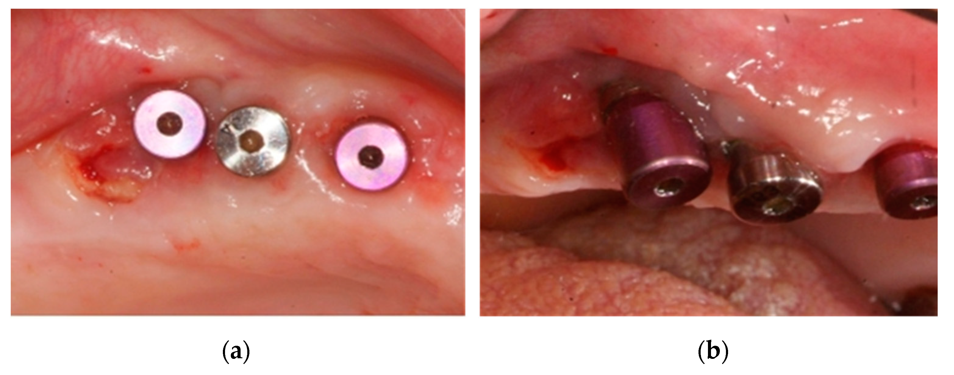 Ijerph 18 01018 g009