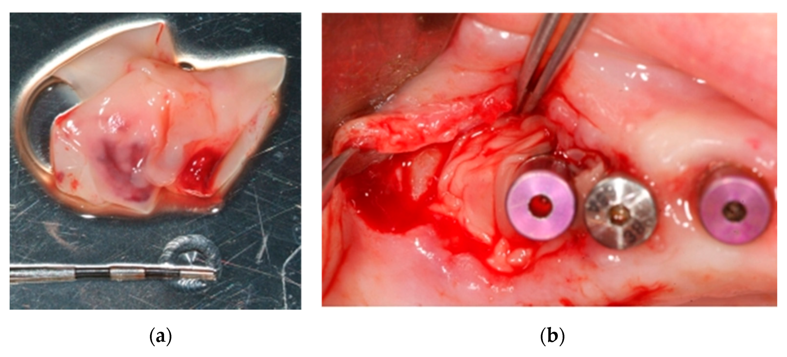 Ijerph 18 01018 g011