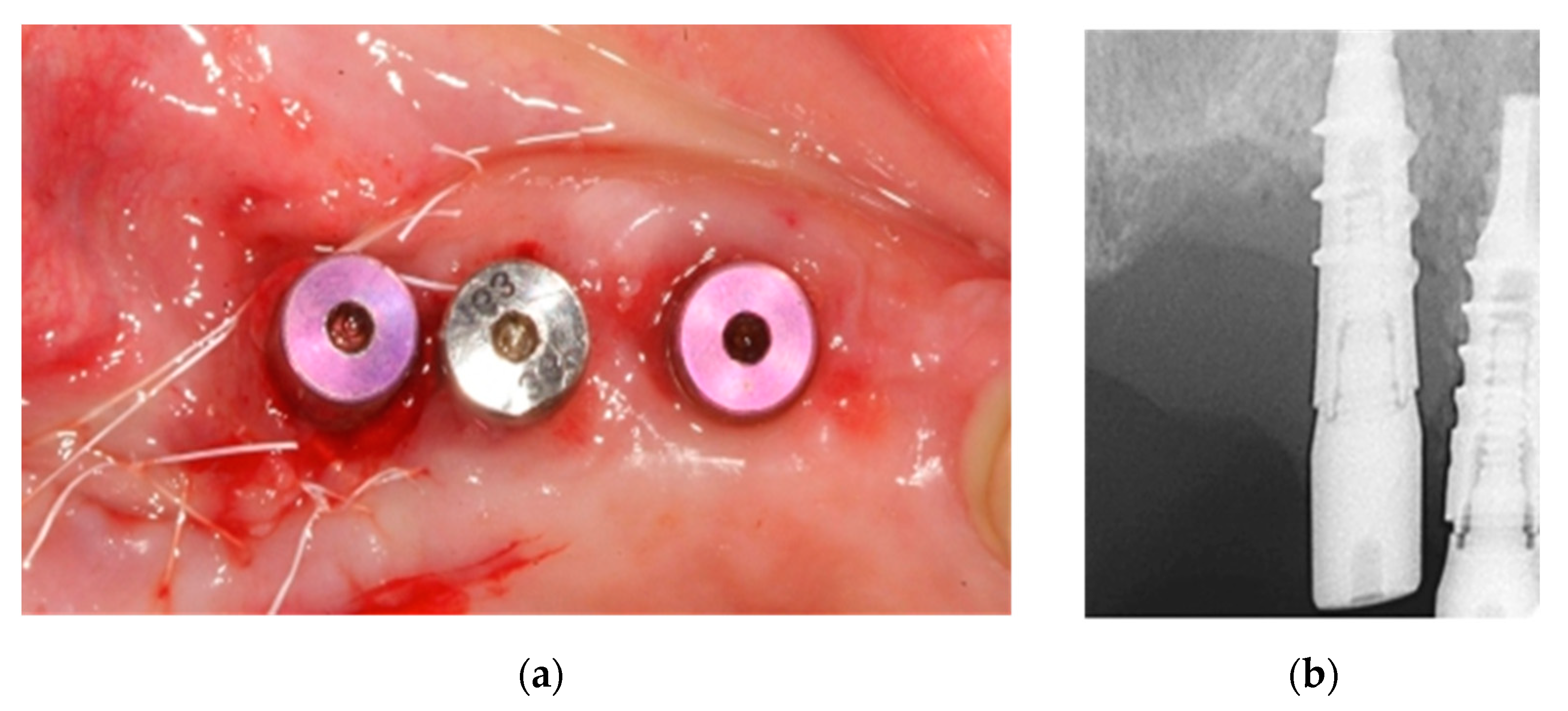 Ijerph 18 01018 g012