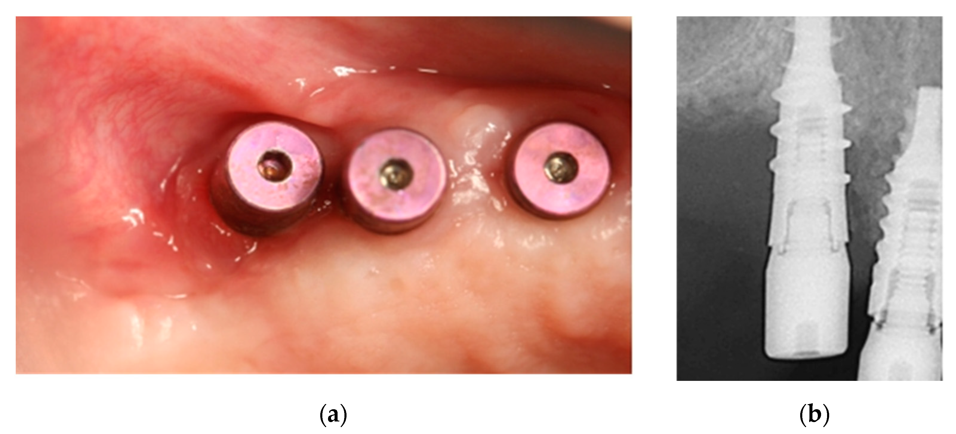 Ijerph 18 01018 g013