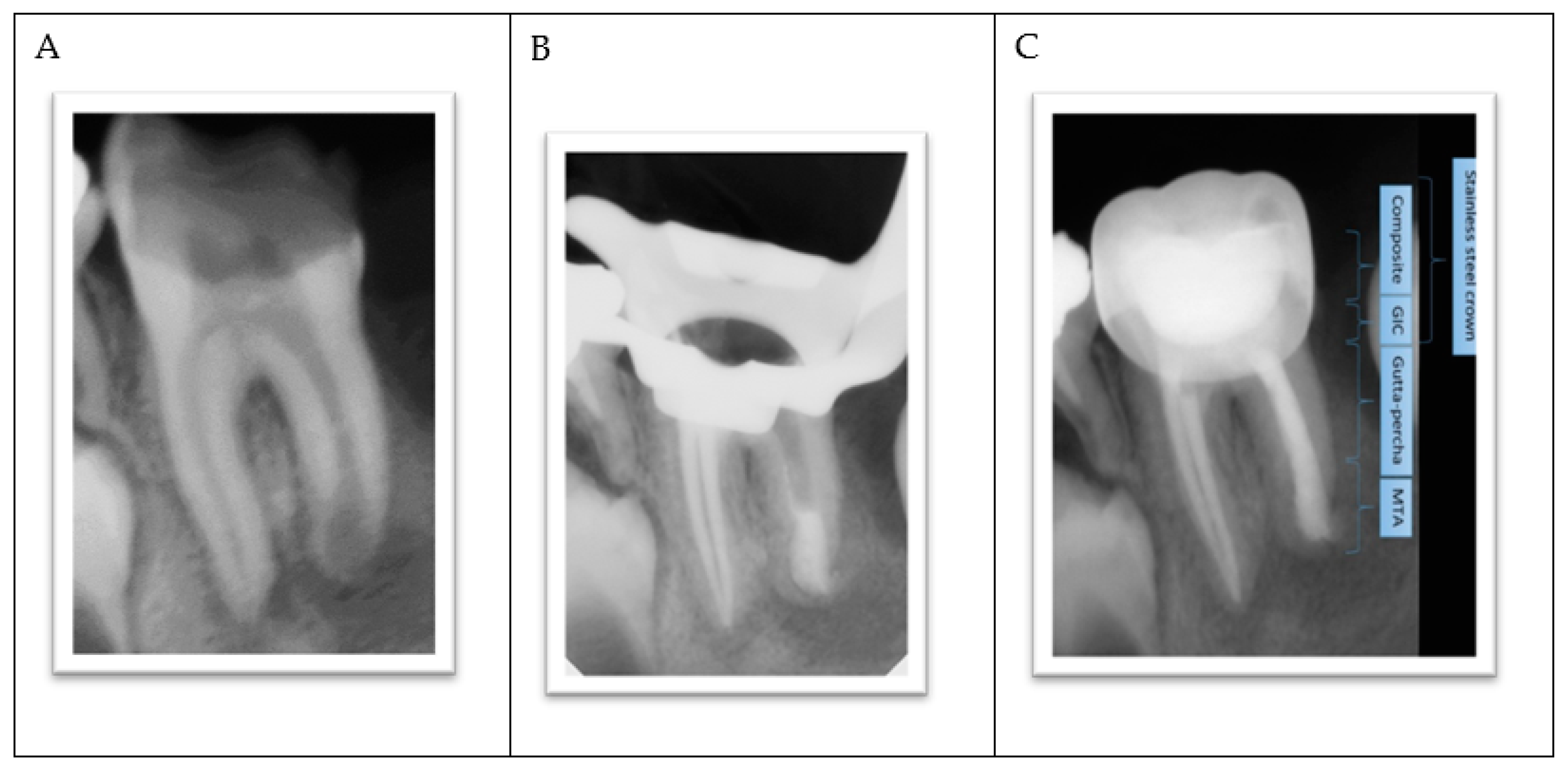Ijerph 18 01209 g004 Ijerph 18 01209 g004