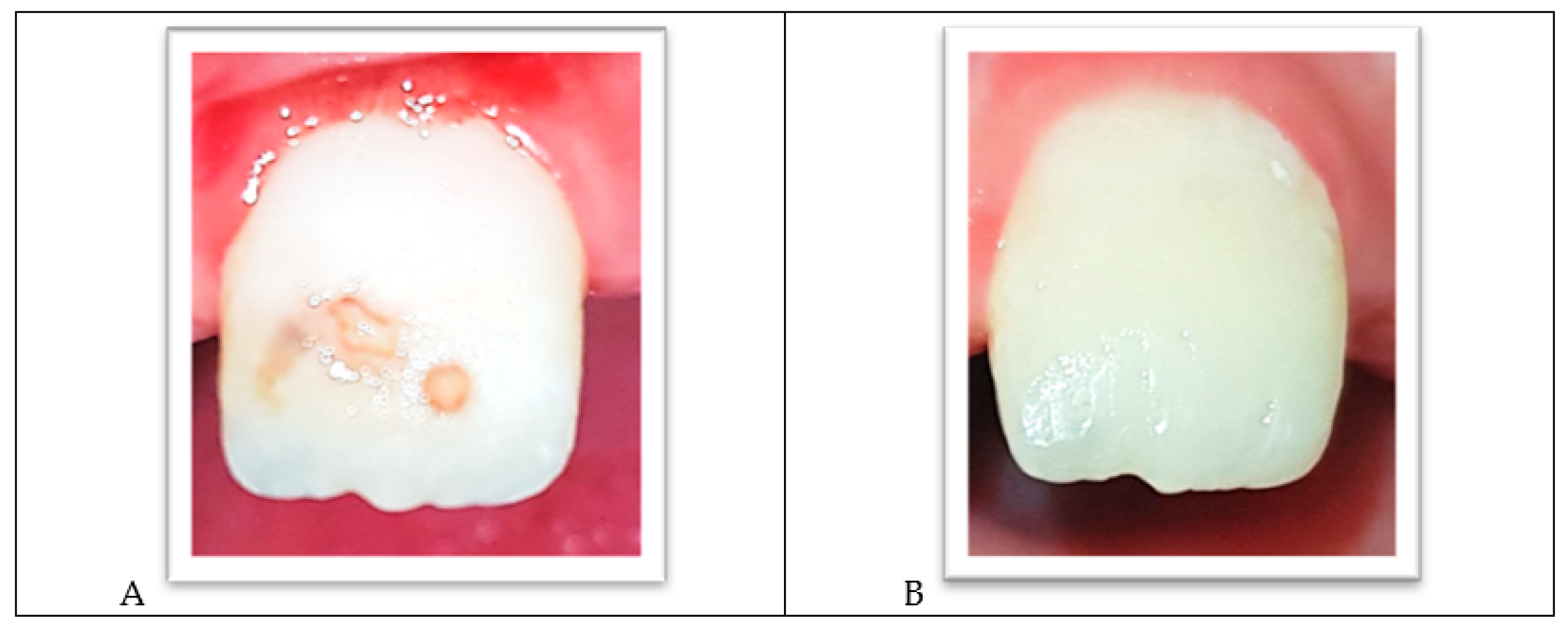 Ijerph 18 01209 g007 Ijerph 18 01209 g007