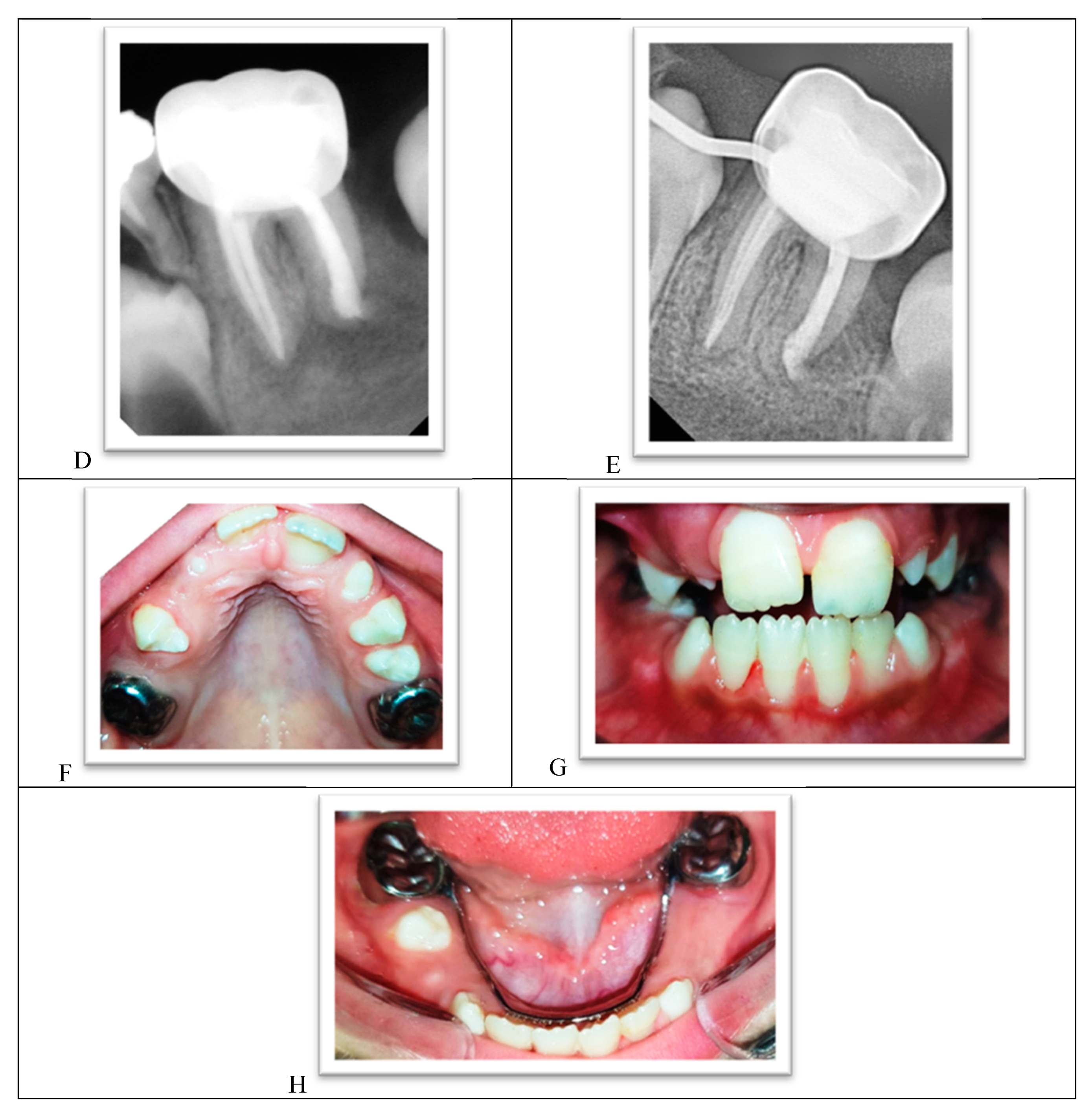 Ijerph 18 01209 g010b Ijerph 18 01209 g010b