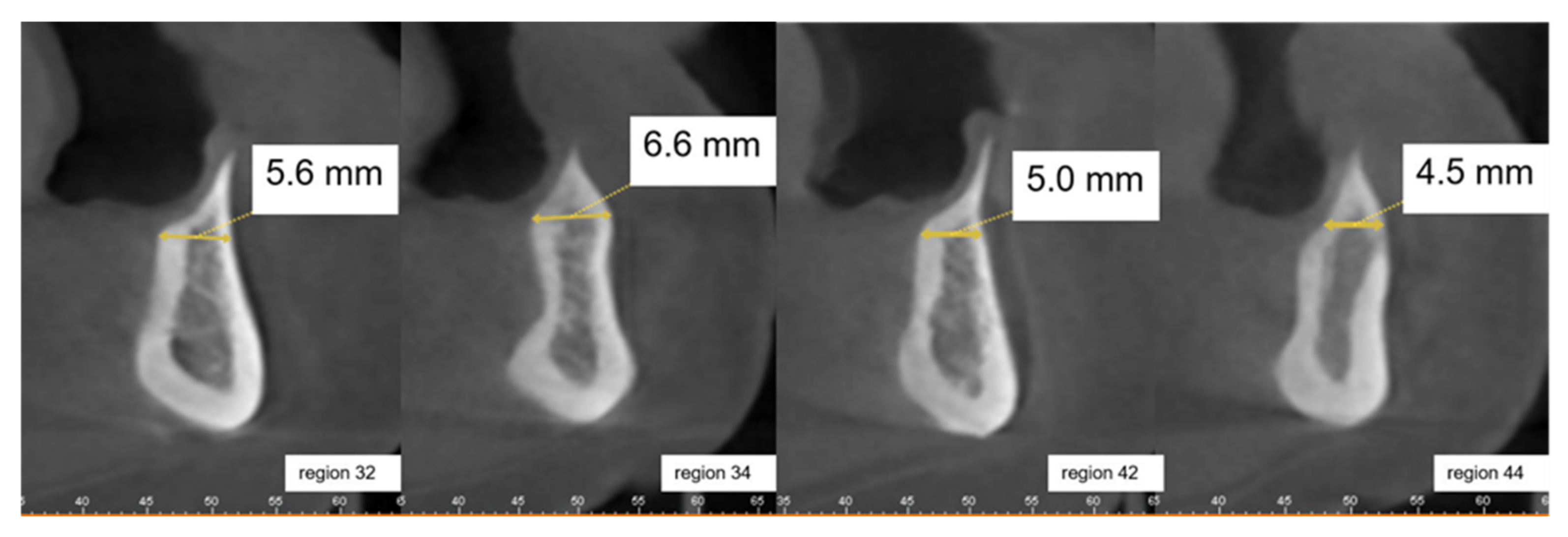 Ijerph 18 01596 g004