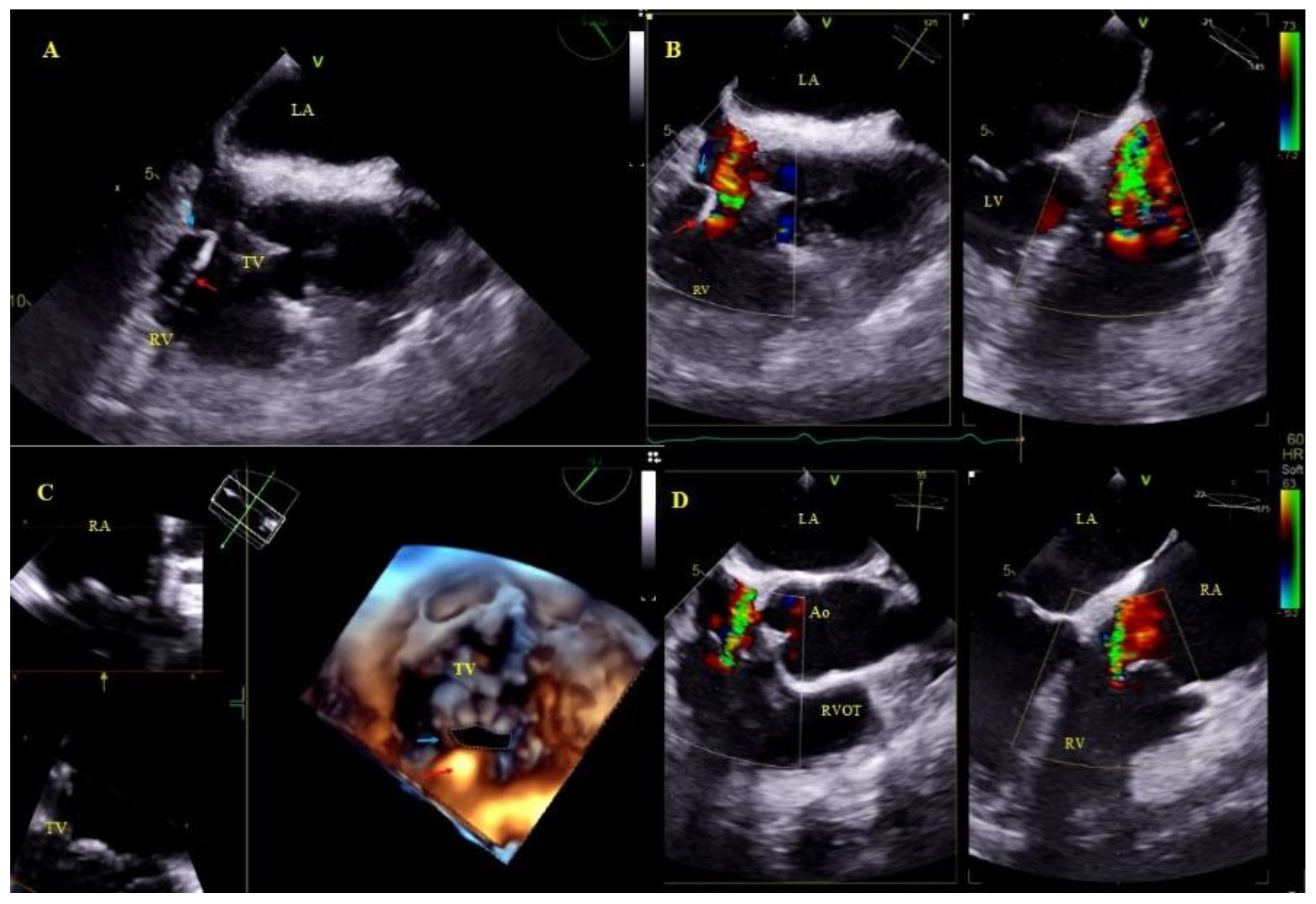 Ijerph 18 01862 g004