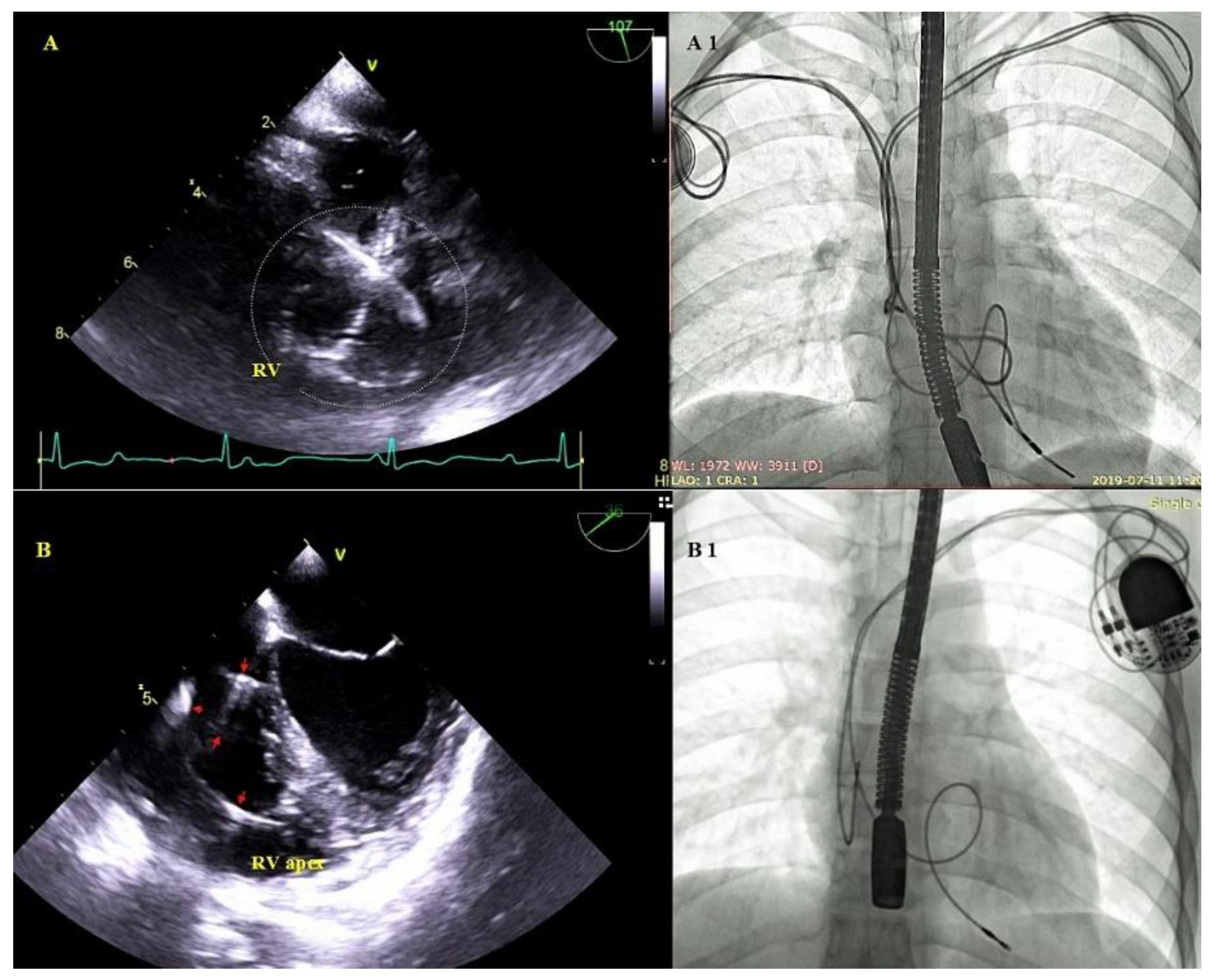 Ijerph 18 01862 g006
