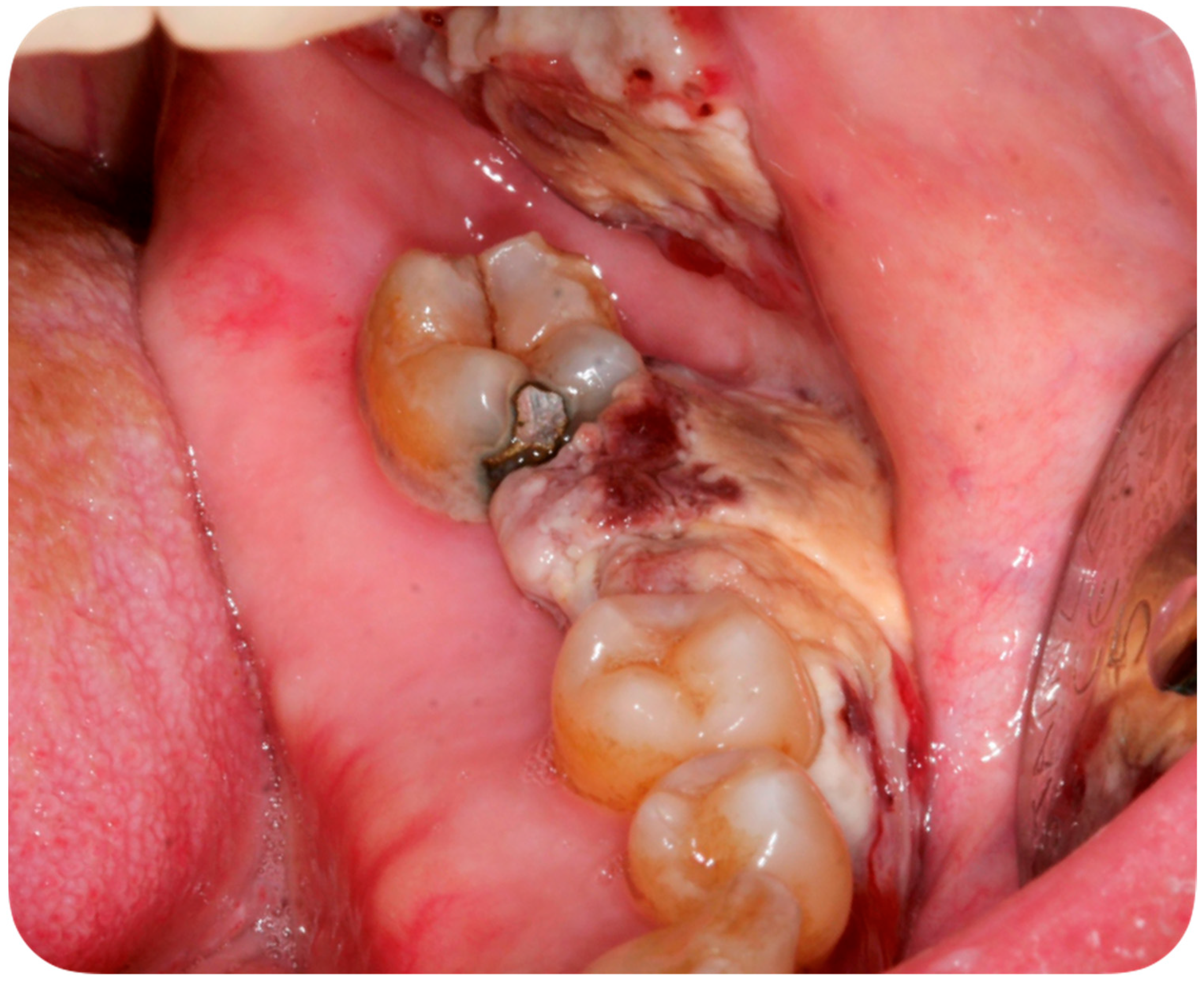 Ijerph 18 02385 g004