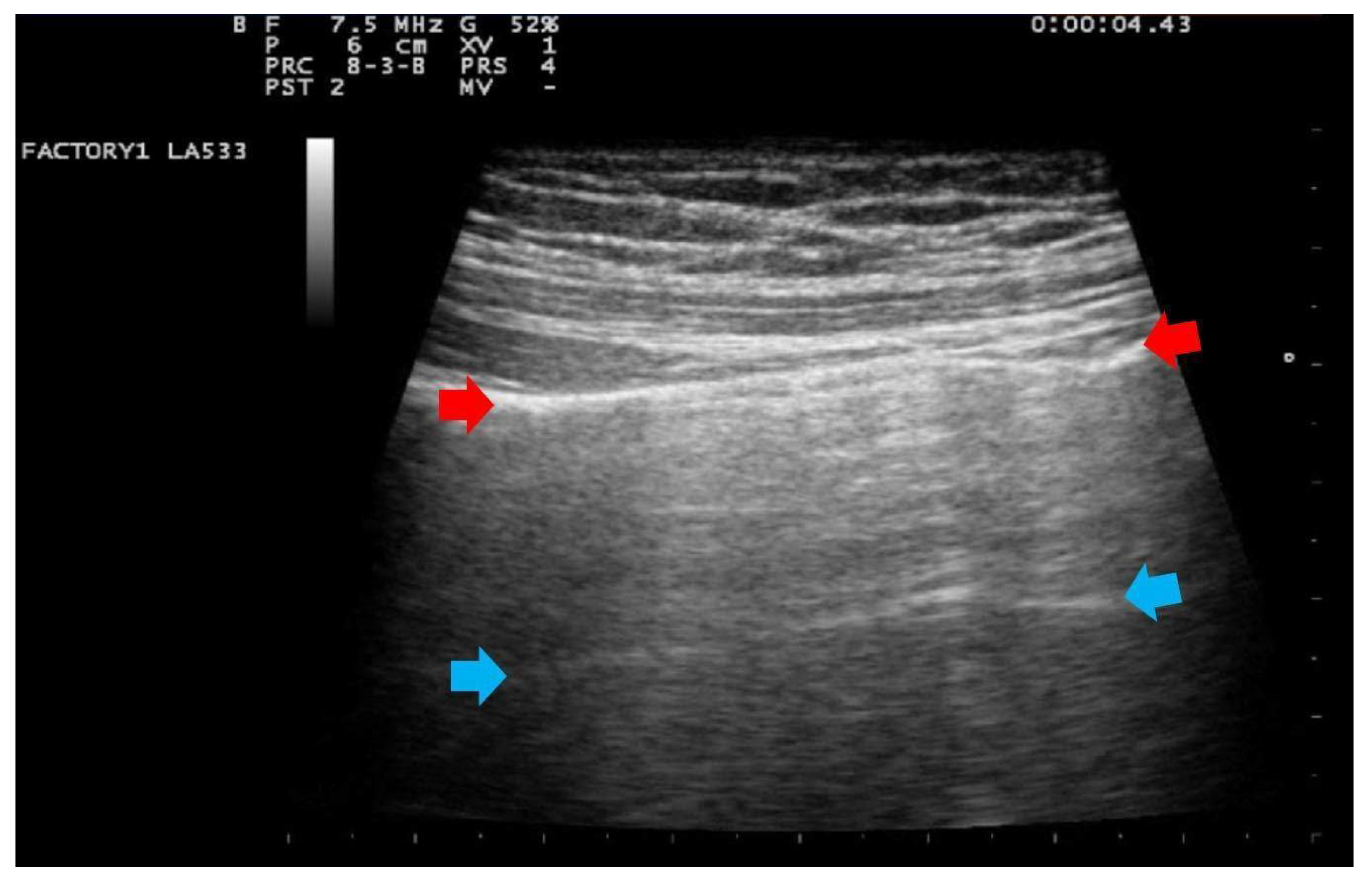 Ijerph 18 02762 g001