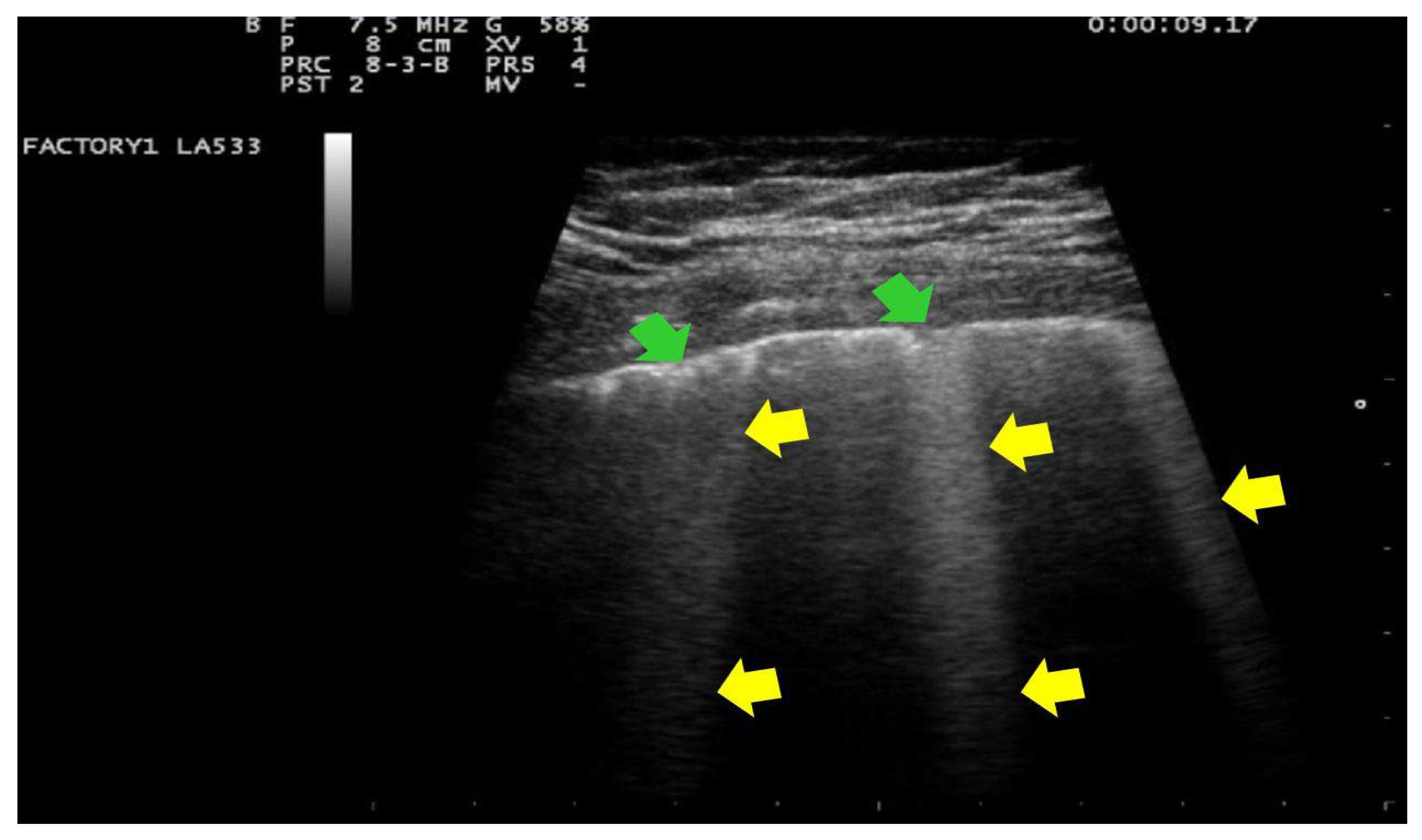 Ijerph 18 02762 g002