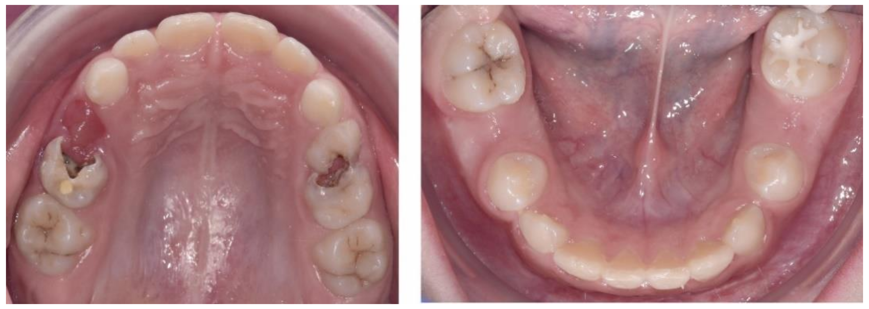 Ijerph 18 03159 g006